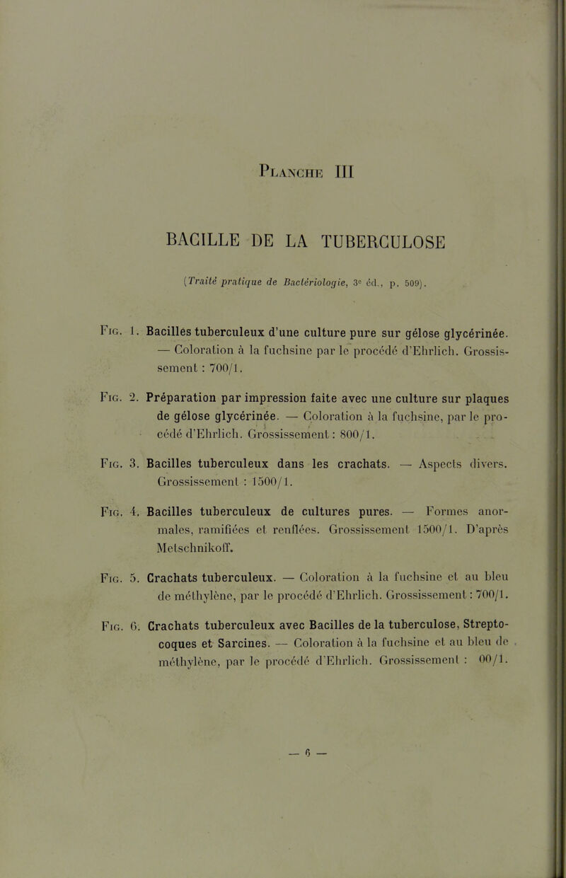 BACILLE DE LA TUBERCULOSE {Traité pratique de Bactériologie, 30 éd., p. 509). FiG. 1. Bacilles tuberculeux d'une culture pure sur gélose glycérinée. — Coloration à la fuchsine par le procédé d'Ehrlich. Grossis- sement : 700/1. FiG. 2. Préparation par impression faite avec une culture sur plaques de gélose glycérinée. — Coloration à la fuchsine, parle pro- cédé d'Ehrlich. Grossissement: 800/1. FiG. 3. Bacilles tuberculeux dans les crachats. — Aspects divers. Grossissement : 1500/1. FiG. 4. Bacilles tuberculeux de cultures pures. — Formes anor- males, ramifiées et renflées. Grossissement 1500/1. D'après Metschnikoff. FiG. 5. Crachats tuberculeux. — Coloration à la fuchsine et au bleu de méthylène, par le procédé d'Ehrhch. Grossissement : 700/1. FiG. 6. Crachats tuberculeux avec Bacilles de la tuberculose, Strepto- coques et Sarcines. — Coloration à la fuchsine et au bleu de . méthylène, par le procédé d'Ehrlich. Grossissement : 00/1.