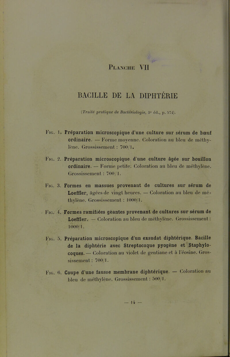 BACILLE DE LA DIPHTÉRIE {Traité pratique de Bactériologie, 3« éd., p. 574). FiG. 1. Préparation microscopique d'une culture sur sérum de bœuf ordinaire. — Forme moyenne. Coloration au bleu de méthy- lène. Grossissement: 700/1, FiG. 2. Préparation microscopique d'une culture âgée sur bouillon ordinaire. — Forme jDetite. Coloration au bleu de méthylène. Grossissement : 700/1. FiG. 3. Formes en massues provenant de cultures sur sérum de Loeffler, âgées de vingt heures. — Coloration au bleu de mé- thylène. Grossissement : 1000/1. FiG. 4. Formes ramifiées géantes provenant de cultures sur sérum de Loeffler. — Coloration au bleu de méthylène. Grossissement : 1000/1. FiG. 5. Préparation microscopique d'un exsudât diphtérique. Bacille de la diphtérie avec Streptocoque pyogène et Staphylo- coques. — Coloration au violet de gentiane et à l'éosine. Gros- sissement : 700/1. FiG. 6. Coupe d'une fausse membrane diphtérique. — Coloration au bleu de méthylène. Grossissement : 500/1.