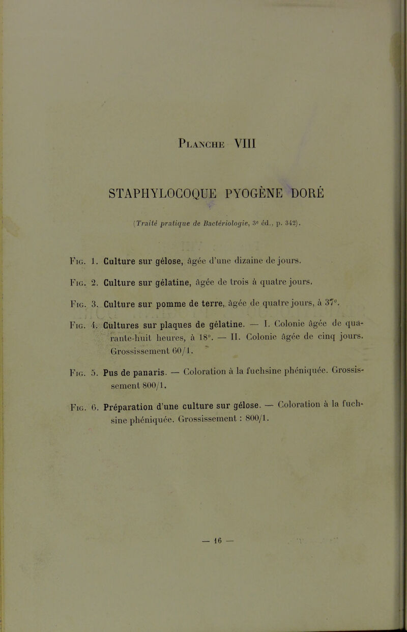 STAPHYLOCOQUE PYOGÈNE DORÉ {Traité pratique de Bactériologie, éd., p. 342). FiG. 1. Culture sur gélose, âgée d'une dizaine de jours, FiG. 2. Culture sur gélatine, âgée de trois à quatre jours. FiG. 3. Culture sur pomme de terre,, âgée de quatre jours, à 37, FiG. 4. Cultures sur plaques de gélatine. — I. Colonie âgée de qua- rante-huit heures, à 18°. — II. Colonie âgée de cinq jours. Grossissement 60/1. FiG. 5. Pus de panaris. — Coloration à la fuchsine phéniquée. Grossis- sement 800/1. FiG. 6. Préparation d'une culture sur gélose. — Coloration à la fuch- sine phéniquée. Grossissement : 800/1.