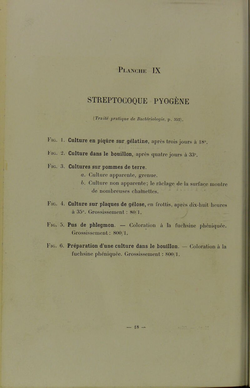 STREPTOCOQUE PYOGÈNE {Traité pratique de Bactériologie, p. 352). FiG. 1. Culture en piqûre sur gélatine, après trois jours à 18°. FiG. '2. Culture dans le bouillon, après quatre jours à 33°. FiG. 3. Cultures sur pommes de terre. a. Culture apparente, grenue. b. Culture non apparente; le râclage de la surface montre de nombreuses chamettes. FiG. 4. Culture sur plaques de gélose, en frottis, après dix-huit heures à 35°. Grossissement : 80/1. FiG. 5. Pus de phlegmon. — Coloration à la fuchsine phéniquée. Grossissement: 800/1. FiG. 6. Préparation d'une culture dans le bouillon. — Coloration à la fuchsine phéniquée. Grossissement : 800/1.