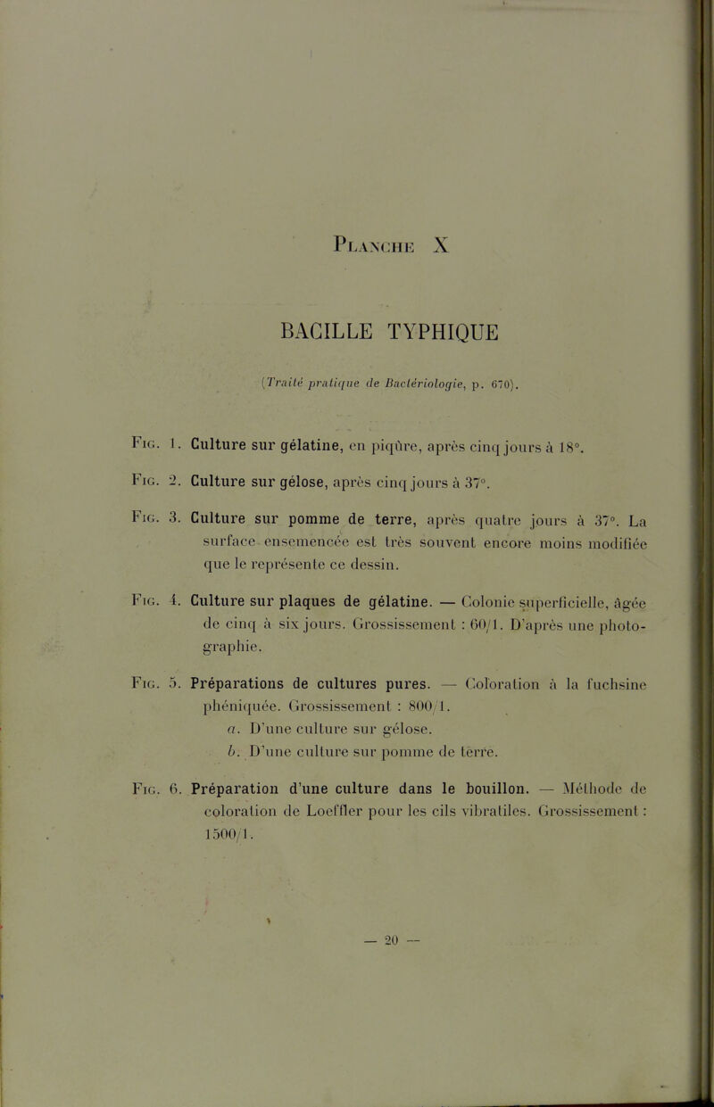 BACILLE TYPHIQUE {Traité pratique de Bactériologie, p. 670), FiG. 1. Culture sur gélatine, en piqûre, après cinq jours à 18°. FiG. '2. Culture sur gélose, après cinq jours à 37°. FiG. 3. Culture sur pomme de terre, après quatre jours à 37°. La surface ensemencée est très souvent encore moins modifiée que le représente ce dessin. FiG. 4. Culture sur plaques de gélatine. — Colonie superficielle, âgée de cinq à six jours. Grossissement : 60/1. D'après une photo- graphie. FiG. 5. Préparations de cultures pures. — Coloration à la fuchsine phéniquée. Grossissement : 800/1. a. D'une culture sur gélose. b. D'une culture sur pomme de tèrre. FiG. 6. Préparation d'une culture dans le bouillon. — Méthode de coloration de Loeffler pour les cils vibratiles. Grossissement : 1500/1. — 20 —