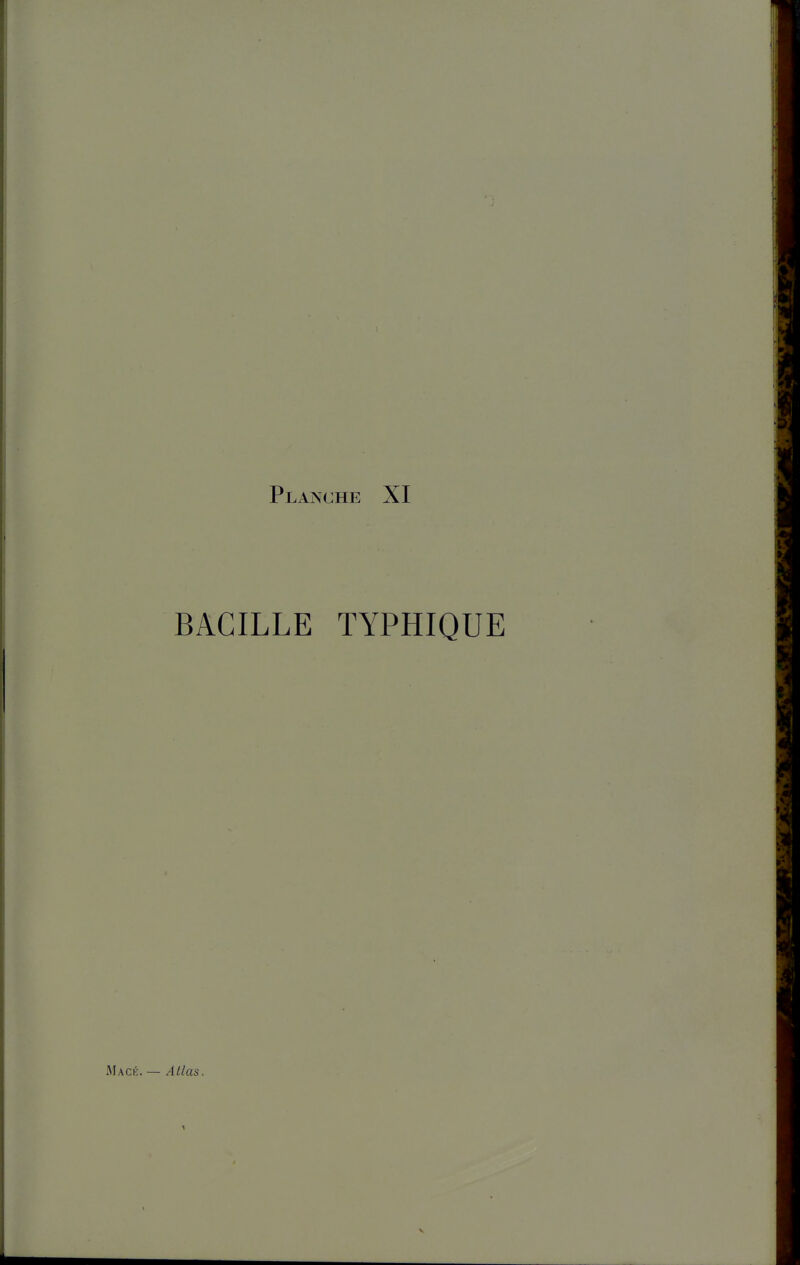 BACILLE TYPHIQUE Mack. — Allas.