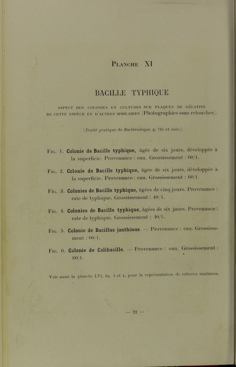 BACILLE TYPHIQUE ASPECT DKS COLONIliS EN CULTURES SUR PLAQUES DE GELATINE DE CETTE ESPÈCE ET d'autres SIMILAIRES (Photographies sans retouches). {Trailé pratique de Bactériologie, p. 715 et suiv.) FiG. 1. Colonie de Bacille typhique, âgée de six jours, développée à la superficie. Provenance : eau. Grossissement : 60/1. FiG. 2. Colonie de Bacille typhique, âgée de six jours, développée à la superficie. Provenance: eau. Grossissement : 60/1. FiG. 3. Colonies de Bacille typhique, âgées de cinq jours. Provenance : rate de typhique. Grossissement: 40/1. FiG. 4. Colonies de Bacille typhique, âgées de six jours. Provenance : rate de typhique. Grossissement : 40/1. FiG. 5. Colonie de Bacillus janthinus. — Provenance : eau. Grossisse- ment : 60/1. FiG. 6. Colonie de Colibacille. — Provenance : eau. Grossissement : 60/1. Voir aussi la planche LVl, fig-. 3 et 4, pour la représentation de colonies similaires.
