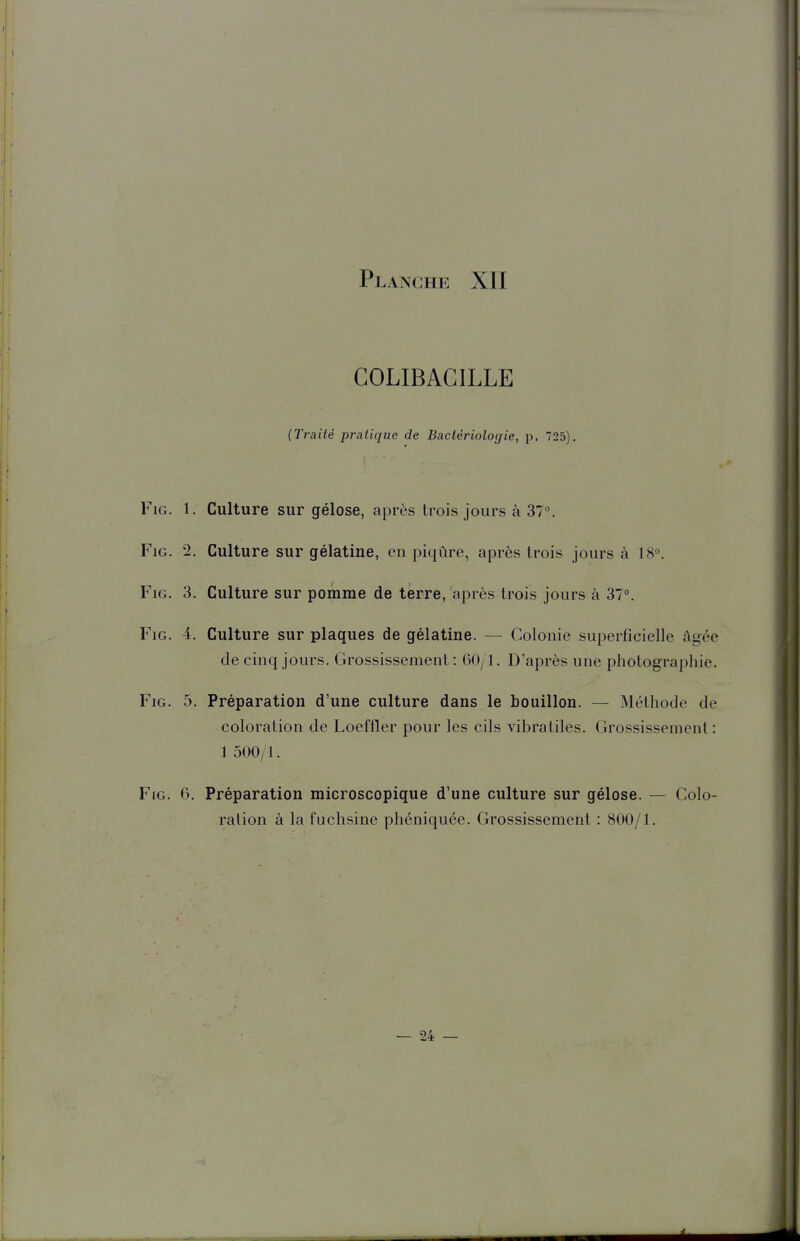 COLIBACILLE (Traité pratique de Bactériologie, p. 725). FiG. 1. Culture sur gélose, après trois jours à 37. FiG. 2. Culture sur gélatine, en piqûre, après trois jours à 18. FiG. 3. Culture sur pomme de terre, après trois jours à 37°. FiG. 4. Culture sur plaques de gélatine. — Colonie superficielle âgée de cinq jours. Grossissement: 60/1. D'après une photographie. FiG. 5. Préparation d'une culture dans le bouillon. — Méthode de coloration de Loeffler pour les cils vibratiles. Grossissement : 1 500/1. FiG. 6. Préparation microscopique d'une culture sur gélose. — Colo- ration à la fuchsine phéniquée. Grossissement : 800/1.