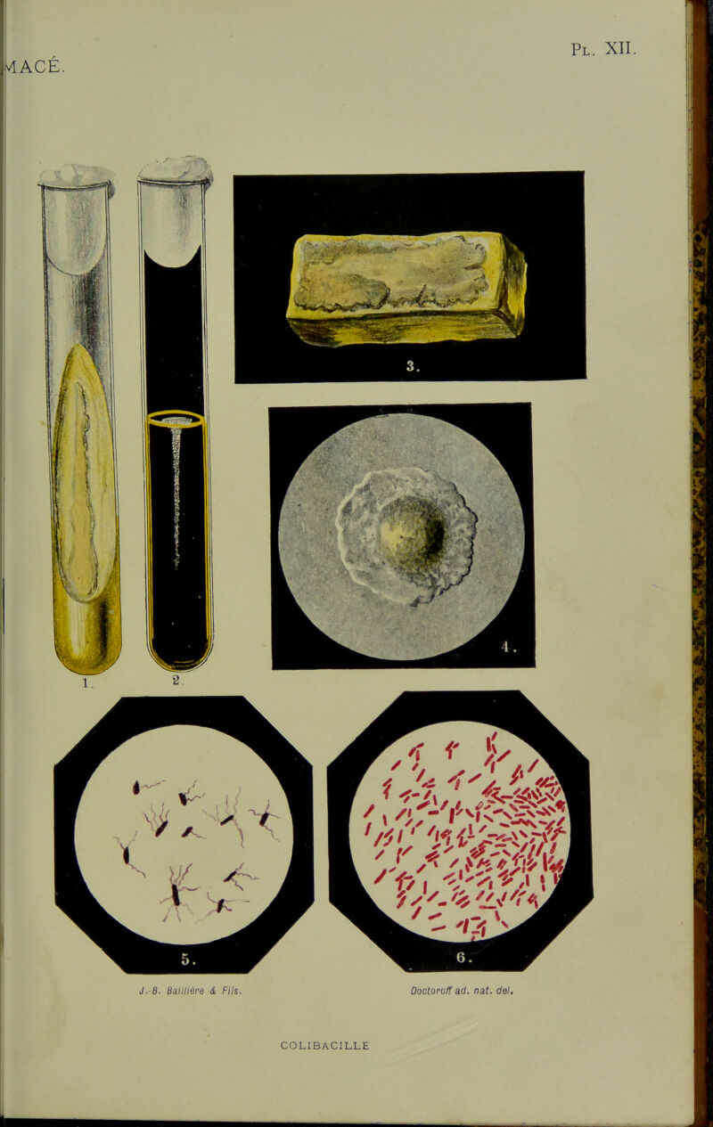 llACÉ. J.-B. Bailliére & Fils. Dootoroïïad. nat. del. COLIBACILLE