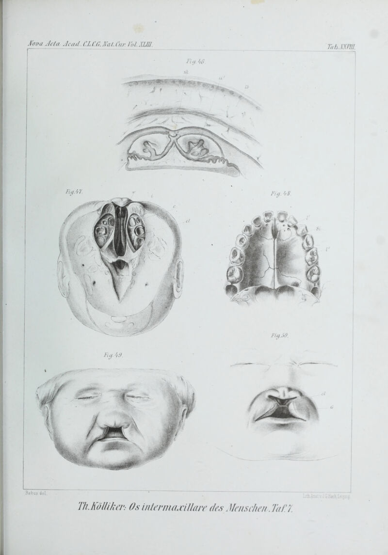 Aopa Jcfa Je ad. C.L.C.Cr.jVal.Car. lol. XUR. Rabus del. Lth-Ansr v u «uach Tli.KölllkiT: Os inlcrnuuHUur des. Uenschen. Taf.7. ^ Tah.xmii Fiij. Uß Fuf. ßS. Fiij. ßß.