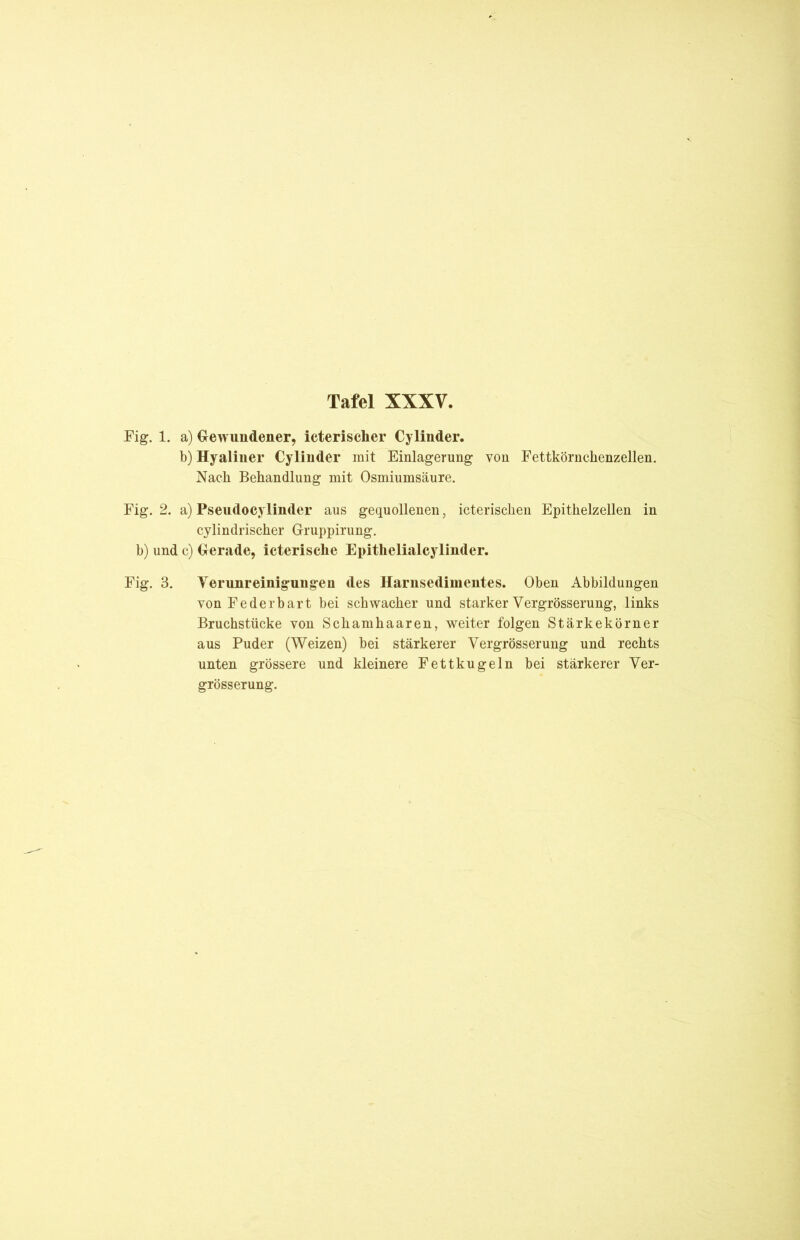 Fig. 1. a) Gewundener, icterischer Cylinder. b) Hyaliner Cylinder mit Einlagerung von Fettkörnchenzellen. Nach Behandlung mit Osmiumsäure. Fig. 2. a) Pseudocylinder aus gequollenen, icterischen Epithelzellen in cylindrischer Gruppirung. b) und c) Gerade, icterische Epithelialcylinder. Fig. 3. Yerunreinigungen des Harnsedimentes. Oben Abbildungen von Federbart bei schwacher und starker Vergrösserung, links Bruchstücke von Schamhaaren, weiter folgen Stärkekörner aus Puder (Weizen) bei stärkerer Vergrösserung und rechts unten grössere und kleinere Fettkugeln bei stärkerer Ver- grösserung.