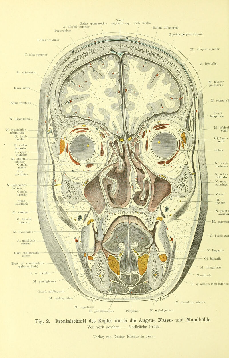 Sinus Cnnclia Superior obliquus superior N. frontalis M. levator - palpebrae M. temporal! Fascia temporalis Galea aponeurolica sagitlalis sup. Faix cerebri ßulbus olfactorius Lamina perpendicularis N. zvgomatico- facialis Concba inferior Sinus maxillaris M. caninus Gl. lacri- malis N. bculo- aiotorius N. infra- orbitalis N. naso- palatinus N. palatii anterior M. zygomat M. buccinator A. maxillaris externa Duct. sublingaalis minor Glaiul. sublingualis f 'M. mylohyoideus N. lingualis Gl. buccalis M. triangularis iXIandibula ~Sl. quadratus labii inferiori N. zygomatico- temporalis N. lacri- malis AI. rectus lateralis Os 2ygo- maticum M. obliquus inferior Coneb.L medin Proc. uncinatus Duct. gl. mandibularis (submaxillaris) M. genioglossus M. geniohyoideus Platysma N- mylohyoideus Fig. 2. Frontalschnitt des Kopfes durch die Augen-, Nasen- und Mundhöhle. Von vorn gesehen. — Natürliche Größe.