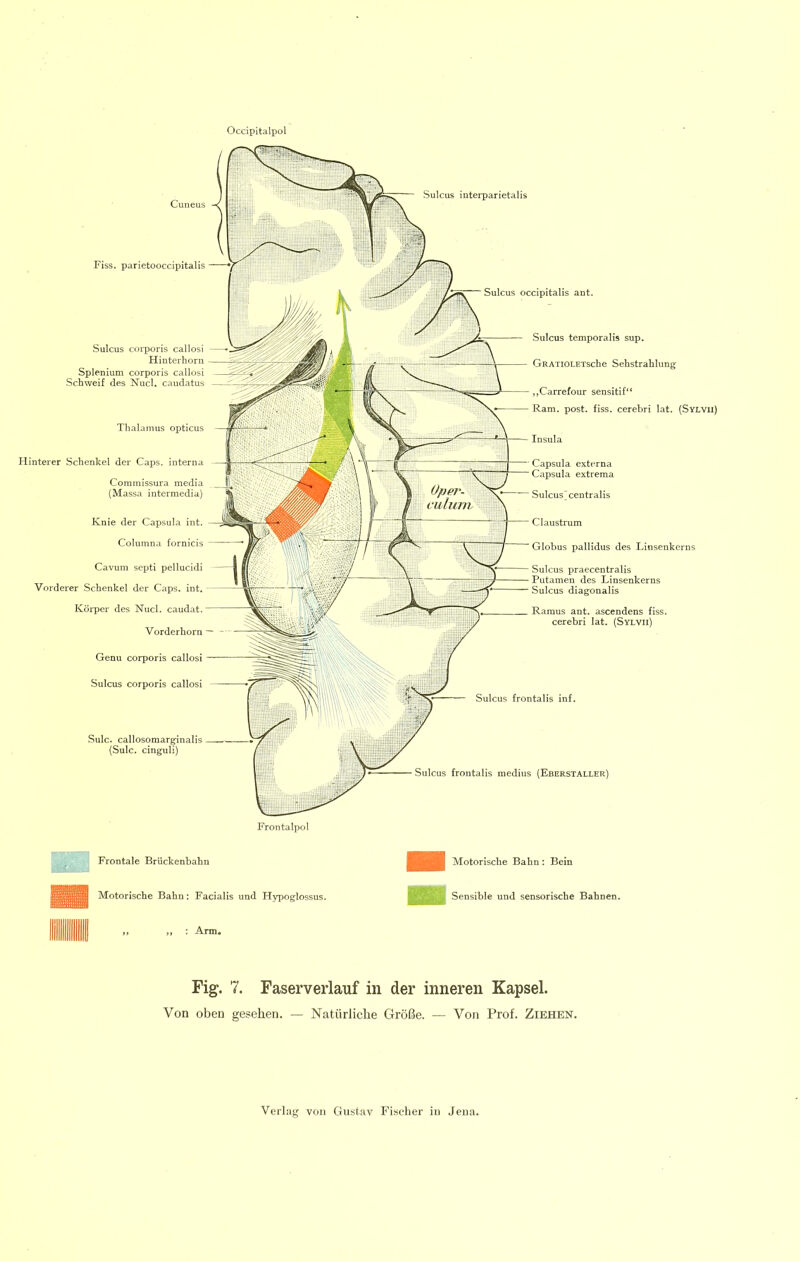 Sulcus frontalis inf. Sulcus frontalis medius (Eberstaller) Sulcus interparietalis Occipitalp( Fiss. parietooccipitalis Sulcus corporis callosi Hinterhorn Splenium corporis callosi Schweif des Nucl, caudatus Thalamus opticus I-linterer Schenkel der Caps, interna Commissura media (Massa intermedia) Knie der Capsula int. Columna fornicis Cavum septi pellucidi Vorderer Schenkel der Caps. int. Köi*per des Nucl. caudat. Vorderhorn Genu corporis callosi Sulcus corporis callosi Sulc. callosomarginalis (Sulc. cinguli) ■ Sulcus occipitalis ant. Sulcus temporalis sup. GRATiOLETsche Sehstrahlung ,,Carrefour sensitif“ Ram. post. fiss. cerehri lat. (Sylvii) Insula Capsula externa Capsula extrema Sulcus’centralis Claustrum Globus pallidus des Linsenkerns Sulcus praecentralis Putamen des Linsenkerns Sulcus diagonalis Ramus ant. ascendens fiss. cerebri lat. (Sylvii) Frontalpol Frontale Brückenbahn Motorische Bahn: Bein Motorische Bahn: Facialh und Hypoglossus. Sensible und sensorische Bahnen. l■llllll Fig. 7. Faserverlauf in der inneren Kapsel. Von oben gesehen. — Natürliche Größe. — Von Prof. Ziehen.