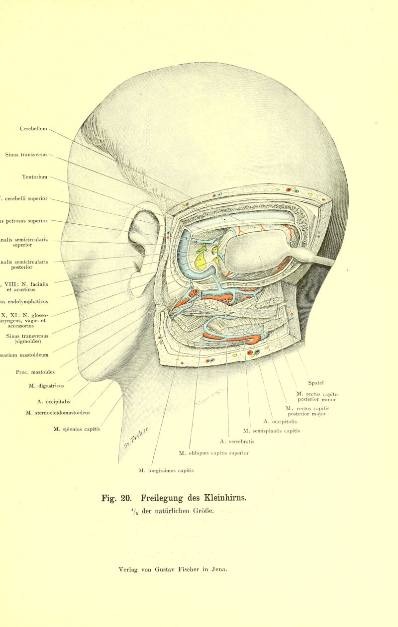 . cerebelli superior IS petrosus superior .nalis semicircularis superior nalis semicircularis posterior VIII; N. facialis et acusticus s endolymphaticus X, XI: N. glosso- aryngeus, vag\is et accessorius Sinus transversus (sigmoides) Proc. mastoides M. digastricus A. occipitalis M. sternocleidomastoideus M. splenius capitis Spatel M. rectus capitis posterior minor I M. semispinalis capitis I A, vertebralis M. obliquus capitis superior M. longissimus capitis M. rectus capitis posterior major A. occipitalis Fig. 20. Freilegung des Kleinhirns. 7s der natürlichen Größe.