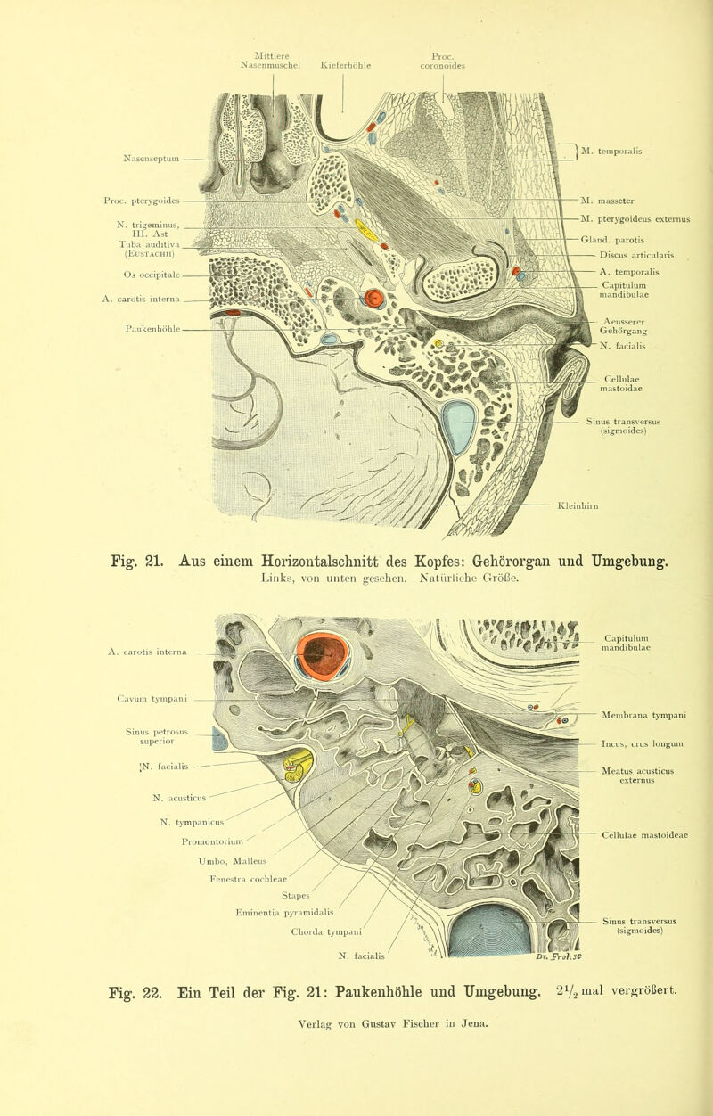 Mittlere Nasenmuschel Kieferhöhle Proc. coronoides Niisenseptum Aeusserer Gehörgang N. facialis Proc. pterygüides N. trigeminus, III. Ast Tuba (EuST.4CHII) M. pterygoideus externus parotis Discus articularis A. temporalis Capitulum mandibulae Sinus transversus (sigmoides) Fig-. 21. Aus einem Horizontalschnitt des Kopfes: Gehörorgan und Umgebung. Links, von unten gesehen. Nalnrlichc Größe. Cavum tympani Sinus petrosus superior ;N. facialis N. acusticus N. tympanicus Promontorium Umbo, Malleus Fencstra cochleae Stapes Eminentia pyramidalis Chorda tympani N. facialis Capitulum mandibulae Menibraua tympani Incus, crus longum Meatus acusticus externus Cellulae mastoideae Sinus transversus (sigmoides) Fig. 22. Ein Teil der Fig. 21: Paukenhöhle und Umgebung. 2Y2 inal vergrößert.