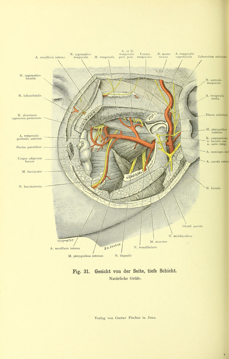 A. maxillaris interna temporalis M. temporalis prof. post, temporales tericus superficialis Tuberculum articulare IST. zygomatico- facialis N. infraorbitalis N. alveolares superiores posteriores A. temporalis profunda anterior Ductus parotideus Corpus adiposum buccae M. buccinator N. buccinatorius N. auricuto- temporalis A. temporalis medla M. pter)'goideus externus R. communicans n. facialis cum n. auric.-temp. A. meningea medi N. mylohyoideus M. masseter N. mandibularis Gland. parotis M. pterygoideus internus N. lingualis Fig^. 31. Gesicht von der Seite, tiefe Schicht. Natürliche Größe.