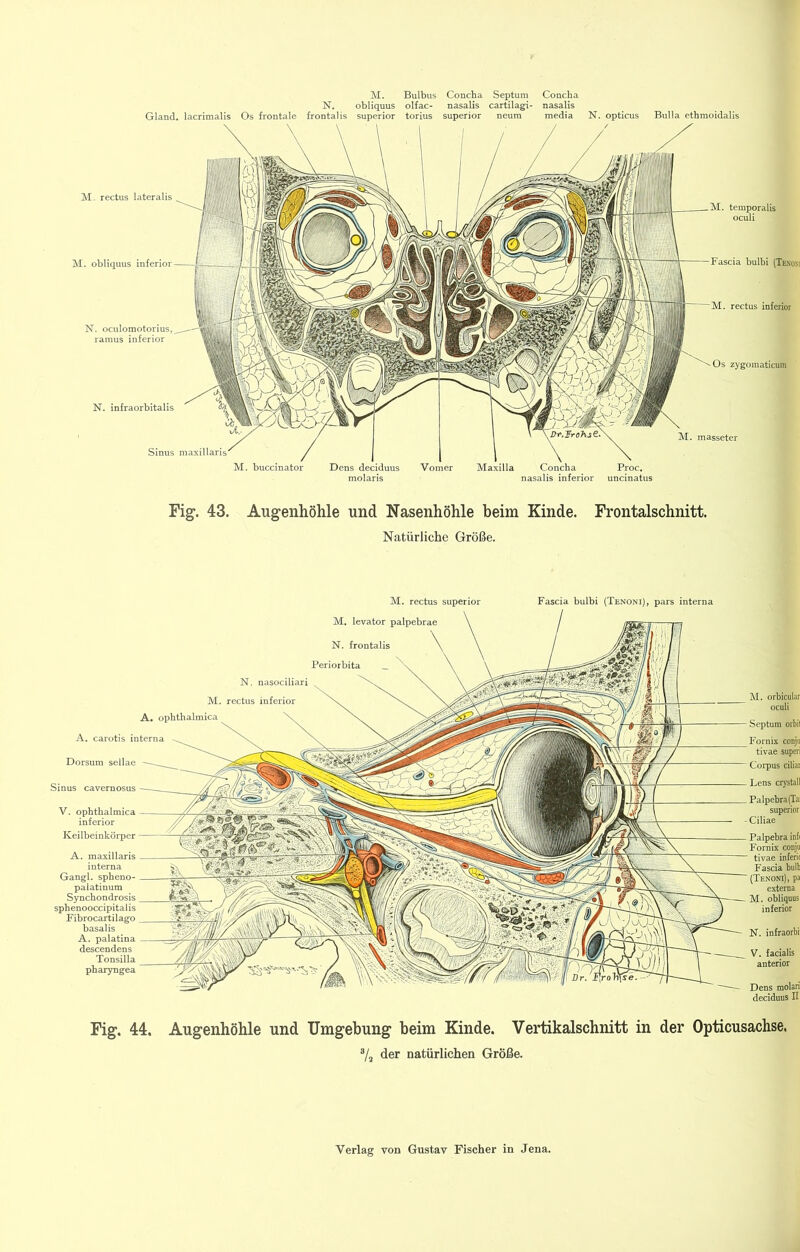 M. Bulbus Concba Septum Concha N. obliquus olfac- nasalis cartilagi- nasalis Gland. lacrimalis Os frontale frontal is Superior torius Superior neum media N. opticus Bulla ethmoidalis M. obliquus M. buccinator Dens temporalis oculi Fascia bulbi (Tenom M. rectus inferior zygomaticum Proc. nasalis inferior uncinatus M. masseter Fig-. 43. Augenhöhle und Nasenhöhle beim Kinde. Frontalschnitt. Natürliche Größe. M. rectus Superior Fascia bulbi (Tenoni), pars interna M. levator palpebrae N. frontalis Periorbita _ N. nasociliari M. rectus inferior A. opbthalmica A. carotis interna Dorsum sellae Sinus cavernosus V. opbthalmica inferior Keilbeinkörper Septum Orbit Fornix conjii tivae superi Corpus ciliar Lens crystall Palpebra(Tai Superior Ciliae A. maxillaris interna Gangl. spbeno- palatinum Syncbondrosis sphenooccipitalis Fibrocartilago basalis A. palatina descendens Tonsilla pbaryngea Palpebra infi Fornix conju tivae inferie Fascia bulb (Tenoni), pa externa M. obliquus inferior N. infraorbil V. facialis anterior Dens molari deciduus II Fig. 44. Augenhöhle und Umgebung beim Kinde. Vertikalschnitt in der Opticusachse. 7ä der natürlichen Größe.