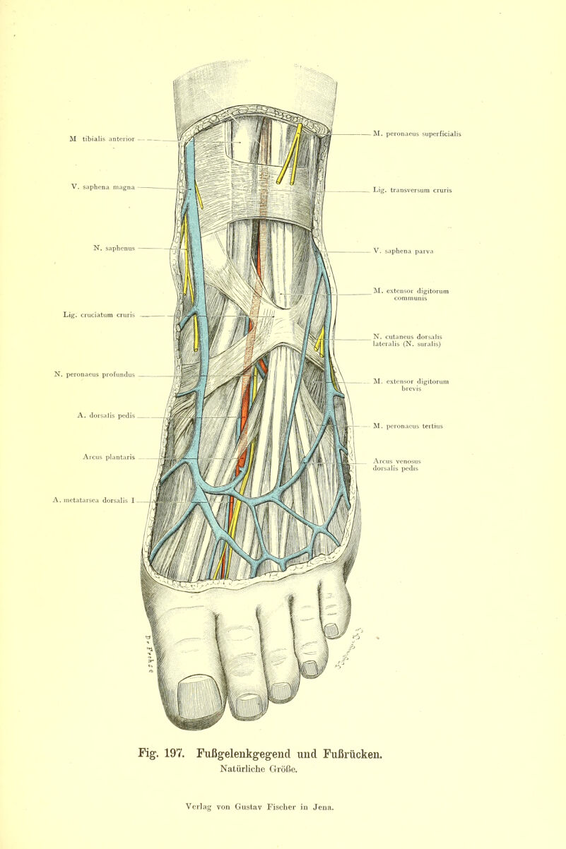 N. saphenus Lig; cruciatum cruris N. peronaeus profundus A. dorsalis pedis Arcus plantaris A. metatarsca dorsalis I Lig. transversum cruris V. saphena parva M. extensor digitorum communis N. cutaneus dorsalis lateralis (N. suralis) M. extensor digitorum brevis M. peronaeus teitius Arcus venosus dorsalis pedis M. peronaeus superficialis Fig. 197. Fußgelenkgegend und Fußrücken. Natürliche Größe.