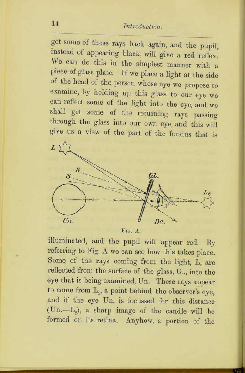 get some ot these rajs back again, and the pupil, instead of appearing black, will give a red reflex! We can do tllis in the simplest manner with a piece ot glass plate. If we place a light at the side of the head of the person whose eye we propose to examine, by holding up this glass to our eye we can reflect some of the light into the eye, and we shall get some of the returning rays passing through the glass into our own eye, and this will give us a view of the part of the fundus that is illuminated, and the pupil will appear red. By referring to Fig. A we can see how this takes place. Some of the rays coming from the light, L, are reflected from the surface of the glass, GL, into the eye that is being examined, Un. These rays appear to come from L2, a point behind the observer’s eye, and if the eye Un. is focussed for this distance (Un.—L2), a sharp image of the candle will be formed on its retina. Anyhow, a portion of the