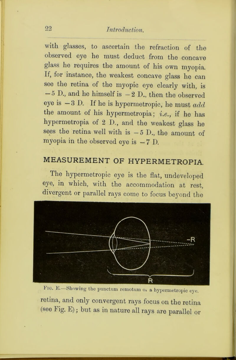 09 An Introduction. with glasses, to ascertain the refraction of the observed eye he must deduct from the concave glass he requires the amount of his own myopia. II, for instance, the weakest concave glass he can see the retina of the myopic eye clearly with, is - 5 D., and he himself is - 2 D., then the observed eye is -3D. If he is hypermetropic, he must acid the amount of his hypermetropia; i.e., if he has hypermetropia of 2 D., and the weakest glass he sees the retina well with is — 5 D., the amount of myopia in the observed eye is — 7 D. MEASUREMENT OF HYPERMETROPIA. The hypermetropic eye is the flat, undeveloped eye, in which, with the accommodation at rest, divergent or parallel rays come to focus bejrnnd the Fig. E.—Showing the punctum remotuin o. a hypermetropic eye. retina, and only convergent rays focus on the retina (see Fig. E); but as in nature all rays are parallel or