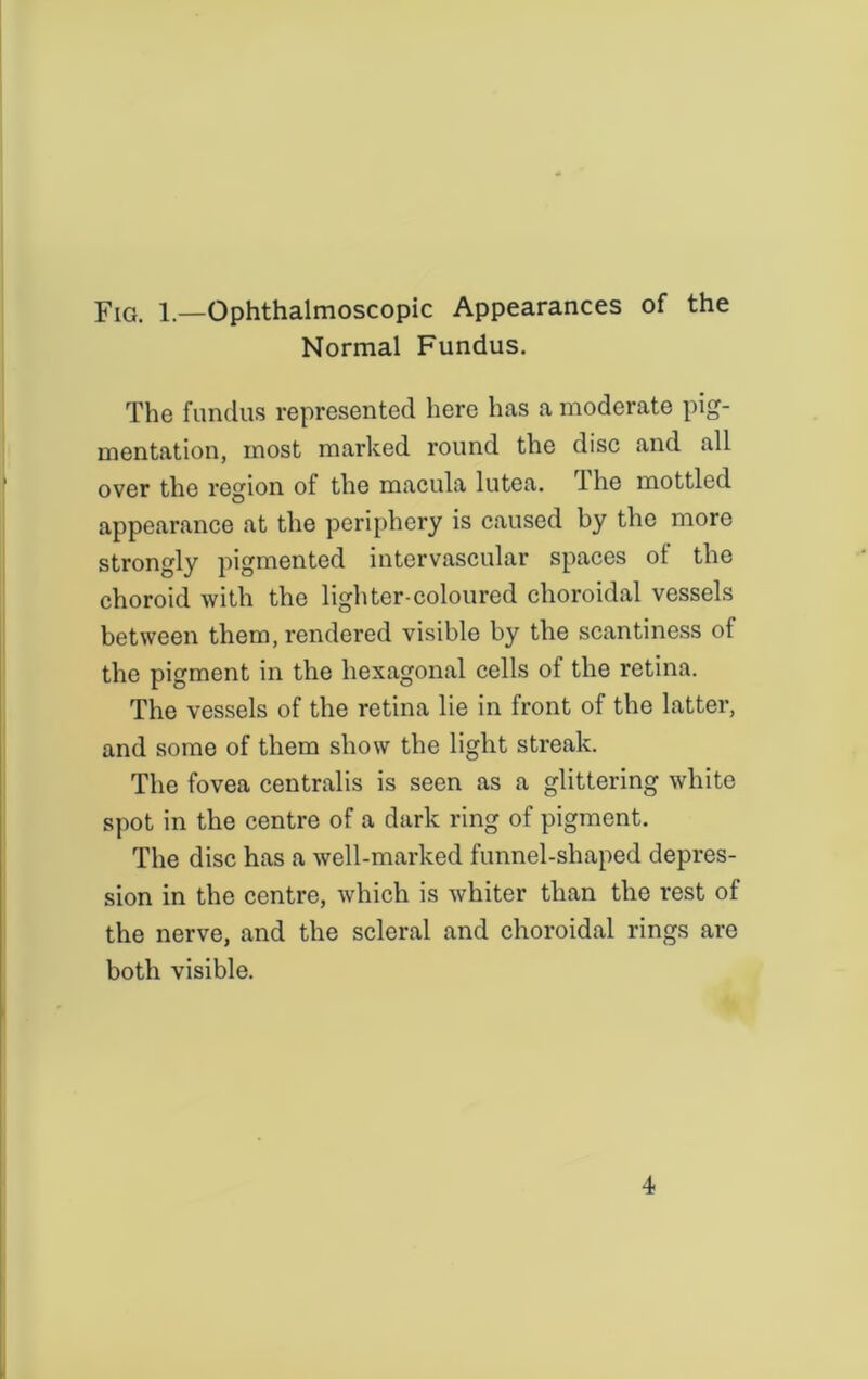 Fig. 1.—Ophthalmoscopic Appearances of the Normal Fundus. The fundus represented here has a moderate pig- mentation, most marked round the disc and all over the region of the macula lutea. 1 he mottled appearance at the periphery is caused by the more strongly pigmented intervascular spaces ot the choroid with the lighter-coloured choroidal vessels between them, rendered visible by the scantiness of the pigment in the hexagonal cells of the retina. The vessels of the retina lie in front of the latter, and some of them show the light streak. The fovea centralis is seen as a glittering white spot in the centre of a dark ring of pigment. The disc has a well-marked funnel-shaped depres- sion in the centre, which is whiter than the rest of the nerve, and the scleral and choroidal rings are both visible. 4