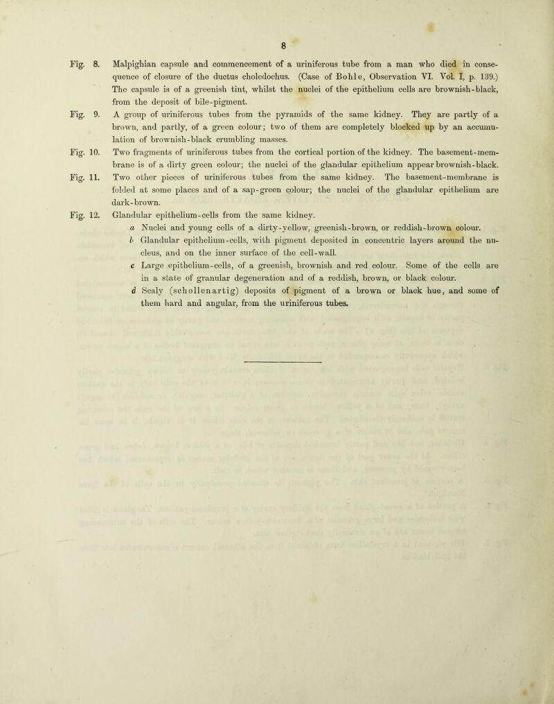 Fig. 8. Fig. 9. Fig. 10. Fig. 11. Fig. 12. Malpighian capsule and commencement of a uriniferous tube from a man who died in conse- quence of closure of the ductus cboledocbus. (Case of Bohle, Observation VI. Vol. I, p. 139.) The capsule is of a greenish tint, whilst the nuclei of the epithelium cells are brownish-black, from the deposit of bile-pigment. A group of uriniferous tubes from the pyramids of the same kidney. They are partly of a brown, and partly, of a green colour; two of them are completely blocked up by an accumu- lation of brownish-black crumbling masses. Two fragments of uriniferous tubes from the cortical portion of the kidney. The basement-mem- brane is of a dirty green colour; the nuclei of the glandular epithelium appear brownish - black. Two other pieces of uriniferous tubes from the same kidney. The basement-membrane is folded at some places and of a sap-green colour; the nuclei of the glandular epithelium are dark-brown. Glandular epithelium - cells from the same kidney. a Nuclei and young cells of a dirty-yellow, greenish-brown, or reddish-brown colour. h Glandular epithelium-cells, with pigment deposited in concentric layers around the nu- cleus, and on the inner surface of the cell-wall. c Large epithelium-cells, of a greenish, brownish and red colour. Some of the cells are in a state of granular degeneration and of a reddish, brown, or black colour, d Scaly (schollenartig) deposits of pigment of a brown or black hue, and some of them hard and angular, from the uriniferous tubes.