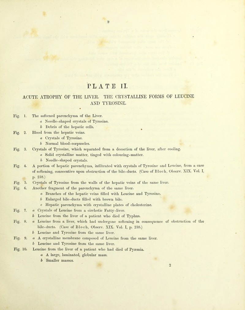 y Fig. Fig. Fig. Fig. Fig. Fig. Fig. Fig. Fig. Fig. PLATE II ACUTE ATROPHY OF THE LIVER. THE CRYSTALLmE FORMS OF LEUCINE AND TYROSINE. 1. The softened parenchyma of the Liver. a Needle-shaped crystals of Tyrosine. b Debris of the hepatic cells. ^ 2. Blood from the hepatic veins. a Crystals of Tyrosine. h Normal blood-corpuscles. 3. Crystals of Tyrosine, which separated from a decoction of the liver, after cooling. a Solid crystalline matter, tinged with colouring-matter. h Needle-shaped crystals. 4. A portion of hepatic parenchyma, infiltrated with crystals of Tyrosine and Leucine, from a case of softening, consecutive upon obstruction of the bile-ducts. (Case of Bloch, Observ. XIX. Vol. I, p. 238.) 5. Crystals of Tyrosine from the walls of the hepatic veins of the same liver. 6. Another fragment of the parenchyma of the same liver. a Branches of the hepatic veins filled with Leucine and Tyrosine. b Enlarged bile-ducts filled with brown bile, c Hepatic parenchyma with crystalline plates of cholesterine. 7. a Crystals of Leucine from a cirrhotic Fatty-liver. b Leucine from the liver of a patient who died of Typhus. 8. a Leucine from a liver, which had undergone softening in consequence of obstruction of the bile-ducts. (Case of Bloch, Observ. XIX. Vol. I, p. 238.) b Leucine and Tyrosine from the same liver. 9. a A crystalline membrane composed of Leucine from the same liver. b Leucine and Tyrosine from the same liver. 10. Leucine from the liver of a patient who had died of Pysemia. a A large, laminated, globular mass. b Smaller masses. 2