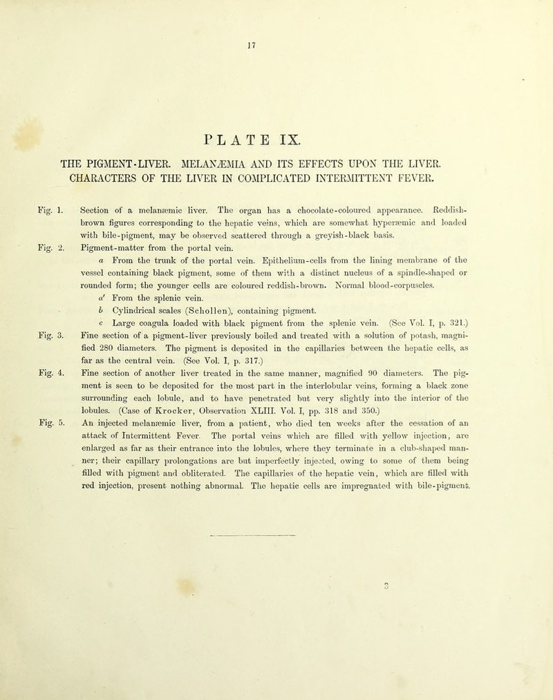 ]7 PLATE IX. THE PIGMENT-LIVER. MELAN^MIA AND ITS EFFECTS UPON THE LIVER. CHARACTERS OF THE LIVER IN COMPLICATED INTERMITTENT FEVER. Fig. 1. Section of a melansemic liver. The organ has a chocolate-coloured appearance. Reddish- brown figures corresponding to the hepatic veins, which are somewhat hypersemic and loaded with bile-pigment, may be observed scattered through a greyish-black basis. Fig. 2. Pigment-matter from the portal vein. a From the trunk of the portal vein. Epithelium-cells from the lining membrane of the vessel containing black pigment, some of them with a distinct nucleus of a spindle-shaped or rounded form; the younger cells are coloured reddish-brown. Normal blood-corpuscle.s. q! From the splenic vein. h Cylindrical scales (Schollen), containing pigment. c Large coagula loaded with black pigment from the splenic vein. (See Vol. I, p. 321.) Fig. 3. Fine section of a pigment-liver previously boiled and treated with a solution of potash, magni- fied 280 diameters. The pigment is deposited in the capillaries between the hepatic cells, as far as the central vein. (See Vol. I, p. 317.) Fig. 4. Fine section of another liver treated in the same manner, magnified 90 diameters. The pig- ment is seen to be deposited for the most part in the interlobular veins, forming a black zone surrounding each lobule, and to have penetrated but very slightly into the interior of the lobules. (Case of Krocker, Observation XLIII. Vol. I, pp. 318 and 350.) Fig. 5. An injected melansemic liver, from a patient, who died ten weeks after the cessation of an attack of Intermittent Fever. The portal veins which are filled with yellow injection, are enlarged as far as their entrance into the lobules, where they terminate in a club-shaped man- ner; their capillary prolongations ai*e but imperfectly injected, owing to some of them being filled with pigment and obliterated. The capillaries of the hepatic vein, which are filled with red injection, present nothing abnormal. Tlie hepatic cells are impregnated with bile-pigment. o