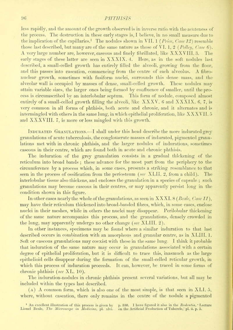 less rapidly, and the amount of the growth observed is in inverse ratio with the acuteness of the process. The destruction in these early stages is, I believe, in no small measure due to the implication of the capillaries.^ The nodules shown in YIl. 1 (^Price, Case 12') resemble those last described, but many are of the same nature as those of VI. 1, 2 {Pollen, Case 6). A very large number are, however, caseous and finely fibrillated, like XXXVIII. 3. The early stages of these latter are seen in XXXIX. 4. Here, as in the soft nodules last described, a small-celled growth has entirely filled the alveoli, growing from the floor, and this passes into caseation, commencing from the centre of each alveolus. A fibro- nuclear growth, sometimes with fusiform nuclei, surrounds this dense mass, and the alveolar wall is occupied by masses of dense, small-celled growth. These nodules may attain variable sizes, the larger ones being formed by confluence of smaller, until the pro- cess is circumscribed by an interlobular septum. This form of nodule, composed almost entirely of a small-celled growth filling the alveoli, like XXXV. G and XXXIX. 6, 7, is very common in all forms of phthisis, both acute and chronic, and it alternates and is intermingled with others in the same lung, in which epithelial proliferation, like XXXVII. 5 and XXXVIII. 7, is more or less mincrled with this growth. Indurated Granulations.-—I shall under this head describe the more indurated grey granulations of acute tuberculosis, the conglomerate masses of indurated, pigmented granu- lations met with in chronic phthisis, and the larger nodules of indurations, sometimes caseous in their centre, which are found both in aciite and chronic phthisis. The induration of the grey granulation consists in a gradual thickening of the reticulum into broad bands ; these advance for the most part from the periphery to the circumference by a process which, in some cases, presents a striking resemblance to that seen in the process of ossification from the periosteum {see XLII. 2, from a child). The interlobular tissue also thickens, and encloses the granulation in a species of capsule ; such granulations may become caseous in their centres, or may apparently persist long in the condition shown in this figure. In other cases nearly the whole of the granulations, as seen in XXXI. 8 {Beale, Case 11), may have their reticulum thickened into broad-banded fibres, which, in some cases, enclose nuclei in their meshes, while in others the nuclei may disappear. Perilobular thickening of the same nature accompanies this process, and the granulations, densely crowded in the lung, may apparently undergo no other change {see XL III. 2). In other instances, specimens may be found where a similar induration to that last described occurs in combination with an amorphous and granular centre, as in XLIII. 1. Soft or caseous granulations may coexist with these in the same lung. I think it probable tliat induration of the same nature may occur in granidations associated with a certain degree of epithelial proliferation, but it is difficult to trace this, inasmuch as the large epithelioid cells disappear during the formation of the small-celled reticular growth, in which this process of induration proceeds. It can, however, be traced in some forms of chronic phthisis {see XL. 10). The induration-nodules in chronic phthisis present several variations, but all may be included within the types last described. (a) a common form, which is also one of the most simple, is that seen in XLI. 5, where, without caseation, there only remains in the centre of the nodule a pigmented ' An excellent illustration of this process is given by p. 330. I have figured it also in the Eodentia, ‘ Lecture Lionel Beale, The Microscope in Medicine, pi. xlvi. on the Artificial Production of Tubercle,’pi. ii. p. 5.