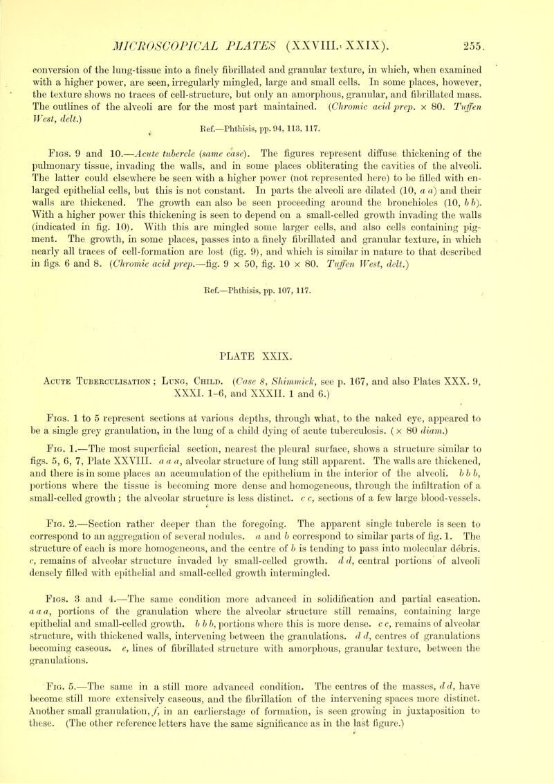 conversion of the lung-tissue into a finely fibrillatecl and granular texture, in which, when examined with a higher power, are seen, irregularly mingled, large and small cells. In some j^laces, however, the texture shows no traces of cell-structure, but only an amorphous, granular, and fibrillated mass. The outlines of the alveoli are for the most part maintained. {Chromic acid i^rej). x 80. Tvffen West, delt.) Eef.—Phthisis, pp. 94, 113, 117. Figs. 9 and 10.—-Acute tubercle (same case). The figures represent diffuse thickening of the pulmonary tissue, invading the walls, and in some places obliterating the cavities of the alveoli. The latter could elsewhere be seen with a higher power (not represented here) to be filled with en- larged epithelial cells, hut this is not constant. In parts the alveoli are dilated (10, a u) and their walls are thickened. The growth can also be seen proceeding around the bronchioles (10, h h). With a higher power this thickening is seen to depend on a small-celled growth invading the walls (indicated in fig. 10). With this are mingled some larger cells, and also cells containing pig- ment. The growth, in some places, passes into a finely fibrillated and granular texture, in which nearly all traces of cell-formation are lost (fig. 9), and which is similar in nature to that described in figs. 6 and 8. (Chromic acid prep.—fig. 9 x 50, fig. 10 x 80. Tuffen West, delt.) Eef.—Phthisis, pp. 107, 117. PLATE XXIX. Acute Tuberculisation ; Lung, Child. (Case 8, Shimmick, see p. 167, and also Plates XXX. 9, XXXI. 1-6, and XXXII. 1 and 6.) Figs. 1 to 5 represent sections at various depths, through what, to the naked eye, appeared to be a single grey granulation, in the lung of a child dying of acute tuberculosis. (x 80 diam.) Fig. 1.—The most superficial section, nearest the pleural surface, shows a structure similar to figs. 5, 6, 7, Plate XXVIII. a a a, alveolar structure of lung still apparent. The walls are thickened, and there is in some places an accumulation of the epithelium in the interior of the alveoli, h h h, jiortions where the tissue is becoming more dense and homogeneous, through the infiltration of a small-celled growth; the alveolar structure is less distinct, c c, sections of a few large blood-vessels. Fig. 2.—Section rather deeper than the foregoing. The apparent single tubercle is seen to correspond to an aggregation of several nodules, a and b correspond to similar parts of fig. 1. The structure of each is more homogeneous, and the centre of b is tending to pass into molecular debris. c, remains of alveolar structure invaded by small-celled growth, d d, central portions of alveoli densely filled with epithelial and small-celled growth intermingled. Figs. 3 and 4.—The same condition more advanced in solidification and partial caseation. a a a, portions of the granulation where the alveolar structure still remains, containing large epithelial and small-celled growth, b b b, portions where this is more dense, c c, remains of alveolar structure, with thickened walls, intervening between the granulations, d d, centres of granulations becoming caseous, e, lines of fibrillated structure with amorphous, granular texture, between the granulations. Fig. 5.—The same in a still more advanced condition. The centres of the masses, dd, have become still more extensively caseous, and the fibrillation of the intervening spaces more distinct. Another small granulation, /, in an earlierstage of formation, is seen growing in juxtaposition to these. (The other reference letters have the same significance as in the last figure.)