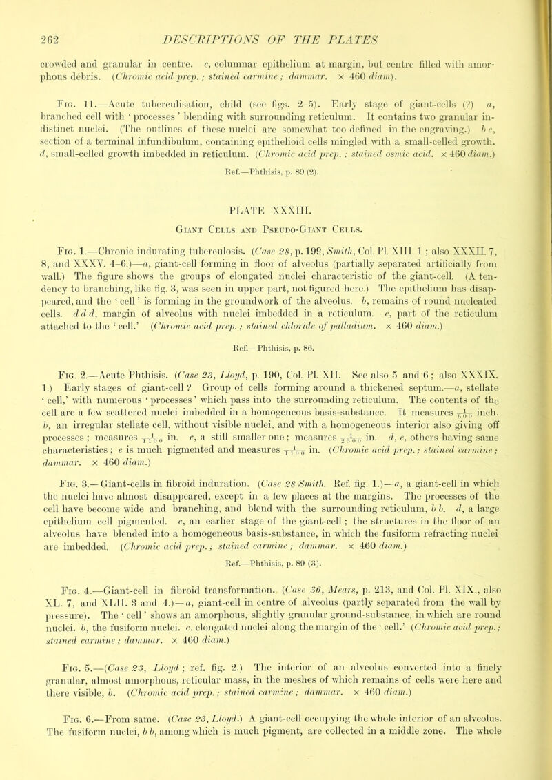 crowded and granular in centre, c, columnar epithelium at margin, but centre filled with amor- phous debris. {Chromic arid 2>rep.; stained carmine; dammar, x -UiO diatn). Fig. 11.—Acute tuberculisation, child (see figs. 2-5). Early stage of giant-cells (?) a, branched cell with ‘ processes ’ l)lending with surrounding reticulum. It contains two granular in- distinct nuclei. (The outlines of these nuclei are somewhat too defined in the engraving.) he, section of a terminal infundibulum, containing epithelioid cells mingled with a small-celled growth. d, small-celled growth imbedded in reticulum. {Chromic acid prep. ; stained osmic acid, x -iiiO diam.) Kef.—Phthisis, p. 89 (‘2). PLATE XXXIII. Giant Cells and Pseudo-Giant Cells. Fig. 1.-—Chronic indurating tuberculosis. {Case 28, p. 199, Smith, Col. PI. XIII. 1 ; also XXXII. 7, 8, and XXXV. 4-6.)—a, giant-cell forming in floor of alveolus (partially separated artificially from wall.) The figure shows the groups of elongated nuclei characteristic of the giant-cell. (A ten- dency to branching, like fig. 3, Avas seen in upper part, not figured here.) The epithelium has disap- peared, and the ‘ cell ’ is forming in the groundwork of the alveolus, h, remains of round nucleated cells, d d d, margin of alveolus with nuclei imbedded in a reticulum, c, part of the reticulum attached to the ‘cell.’ {Chromic acid prep.; stained ddoride of palladium, x 460 diam.) Kef.—Phthisis, p. 80. Fig. 2.—Acute Phthisis. {Ca.se 23, Lloyd, p. 190, Col. PI. XII. See also 5 and 6; also XXXIX. 1.) Early stages of giant-cell ? Group of cells forming around a thickened septum.—a, stellate ‘ cell,’ with numerous ‘ processes ’ which pass into the surrounding reticulum. The contents of the cell are a few scattered nuclei imbedded in a homogeneous hasis-sulistance. It measures iiich. h, an irregular stellate cell, without visible nuclei, and with a homogeneous interior also giving off processes ; measures xxttit iw. c, a still smaller one; measures others having same characteristics ; e is much pigmented and measures x^Vu {Chromic acid prep.; stained carmine; dammar, x 460 diam.) Fig. 3.—Giant-cells in fibroid induration. {Case 28 Smith. Kef. fig. 1.)— u, a giant-cell in which the nuclei have almost disappeared, except in a tew places at the margins. The processes of the cell have become wide and branching, and blend with the surrounding reticulum, h h. d, a large epithelium cell pigmented, e, an earlier stage of the giant-cell; the structures in the floor of an alveolus have blended into a homogeneous basis-substance, in which the fusiform refracting nuclei are imbedded. {Chromic acid prep.; stained carmine ; dammar, x -160 dia)it.) Kef.—Phthisis, p. 89 (3). Fig. 4.—Giant-cell in fibroid transformation. {Case 36, Mears, p. 213, and Col. PI. XIX., also XL. 7, and XLII. 3 and 4.) —u, giant-cell in centre of alveolus (partly separated from the wall by pressure). The ‘ cell ’ shows an amorphous, slightly granular ground-substance, in Avhich are round nuclei, h, the fusiform nuclei, c, elongated nuclei along the margin of the ‘ cell.’ {Chromic acid prep.; .stained carmine; dammar, x 460 diam.) Fio. 5.—{Case 23, Lloyd ; ref. fig. 2.) The interior of an alveolus converted into a finely granular, almost amorphous, reticular mass, in the meshes of Avhich remains of cells were here and there visible, {Chromic acid prep.; stained carmine ; dammar, x 460 diam.) Fig, 6.—From same. {Case 23, Lloyd.) A giant-cell occupying the whole interior of an alveolus. The fusiform nuclei, h h, among which is much pigment, are collected in a middle zone. The whole