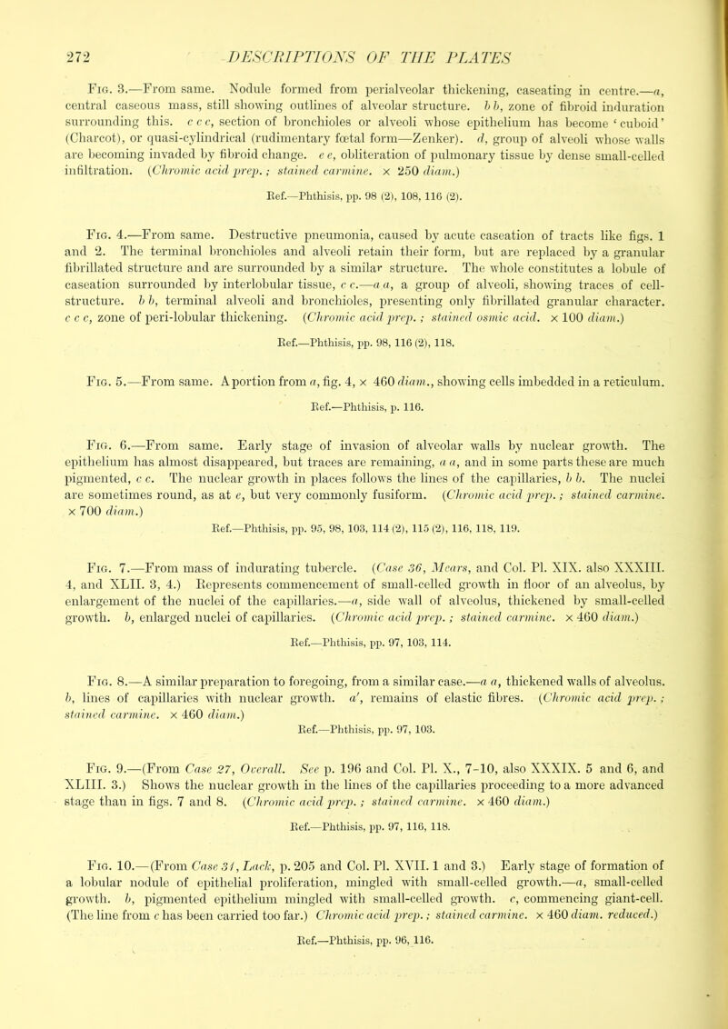 Fig. 3.—From same. Nodule formed from perialveolar thickening, caseating in centre.—a, central caseous mass, still showing outlines of alveolar structure, h h, zone of fibroid induration surrounding this, c c c, section of bronchioles or alveoli whose epithelium has become ‘ cuboid ’ (Charcot), or quasi-cylindrical (rudimentary foetal form—Zenker), d, group of alveoli whose walls are becoming invaded by fibroid change, e e, obliteration of pulmonary tissue by dense small-celled infiltration. {Chromic acid prep.; stained carmine, x 250 diam.) Eef.—Phthisis, pp. 98 (2), 108, 116 (2). Fig. 4.—From same. Destructive pneumonia, caused by acute caseation of tracts like figs. 1 and 2. The terminal bronchioles and alveoli retain their form, but are replaced by a granular fibrillated structure and are surrounded by a similar structure. The whole constitutes a lobule of caseation surrounded by interlobular tissue, c c.—a a, a grouii of alveoli, showing traces of cell- structure. h b, terminal alveoli and bronchioles, presenting only fibrillated granular character. c c c, zone of peri-lobular thickening. {Chromic acid prep. ; stained osmic acid, x 100 diam.) Eef.—Phthisis, pp. 98, 116 (2), 118. Fig. 5.—From same. Aportion from a, fig. 4, x 460 diam., showing cells imbedded in a reticulum. Eef.—Phthisis, jj. 116. Fig. 6.—From same. Early stage of invasion of alveolar walls by nuclear growTh. The epithelium has almost disappeared, but traces are remaining, a a, and in some parts these are much pigmented, c c. The nuclear growth in places follows the lines of the capillaries, h h. The nuclei are sometimes round, as at c, but very commonly fusiform. {Chromic acid prep.; stained carmine. X 700 diam.) Eef.—Phthisis, pp. 95, 98, 103, 114 (2), 115 (2), 116, 118, 119. Fig. 7.—From mass of indurating tubercle. {Case 36, Mears, and Col. PI. XIX. also XXXIII. 4, and XLII. 3, 4.) Kepresents commencement of small-celled growth in floor of an alveolus, by enlargement of the nuclei of the capillaries.—a, side wall of alveolus, thickened by small-celled growth, h, enlarged nuclei of capillaries. {Chromic acid prep.; stained carmine, x 460 diam.) Eef.—Phthisis, pp. 97, 103, 114. Fig. 8.—A similar jireparation to foregoing, from a similar case.—a a, thickened w'alls of alveolus. h, lines of capillaries with nuclear growth, a', remains of elastic fibres. {Chromic acid prep. ; stained carmine, x 460 diam.) Eef.—Phthisis, pp. 97, 103. Fig. 9.—(From Case 27, Ouerall. See p. 196 and Col. PI. X., 7-10, also XXXIX. 5 and 6, and XLIII. 3.) Shows the nuclear growth in the lines of the capillaries proceeding to a more advanced stage than in figs. 7 and 8. {Chromic acid prep.; stained carmine, x 460 diam.) Eef.—Phthisis, pp. 97, 116, 118. Fig. 10.—(From Case 3i, LaeJ:, p. 205 and Col. PI. XVII. 1 and 3.) Early stage of formation of a lobular nodule of epithelial proliferation, mingled with small-celled growth.—a, small-celled growth, h, pigmented epithelium mingled with small-celled growth, c, commencing giant-cell. (The line from c has been carried too far.) Chromic acid prep.; stained carmine, x 460 diam. reduced.) Eef.—Phthisis, pp. 96, 116.