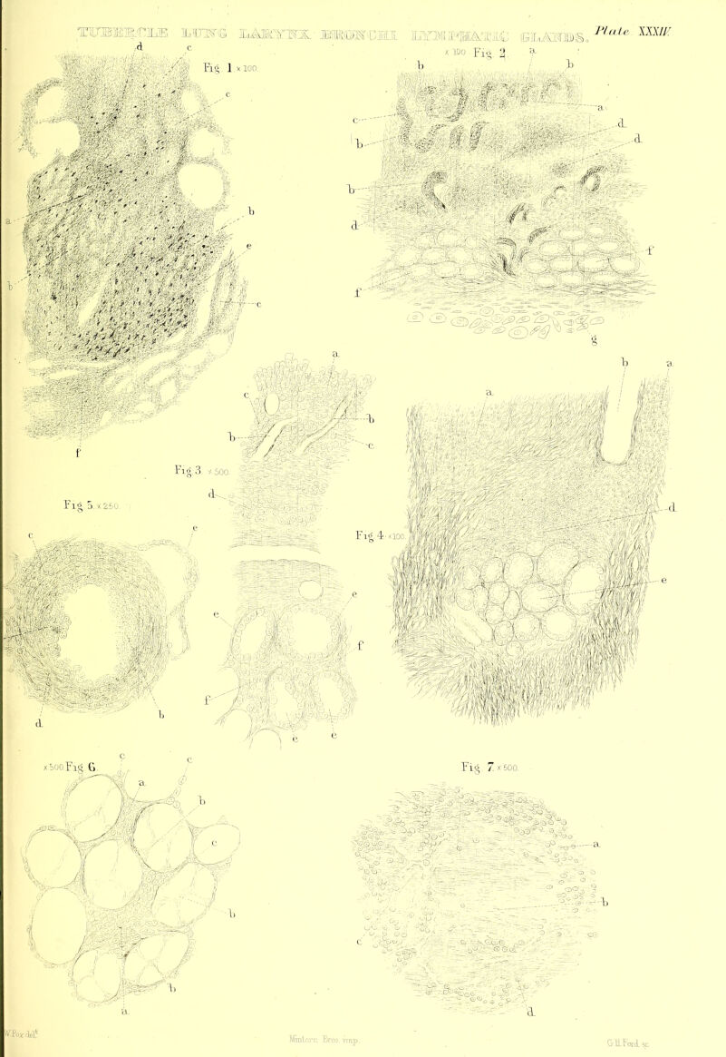TrngiEis^^iL® lUinwicflM: Fi^. 1 yioo. vM'jL^i. X i.Do FFi^ Ij. h XXX//: :fj m -# f p'xrSi ■'1 V Fig, 5.x 250. Fig 7 X 600. ® •.' -T.P -7> lb-- vFj v -1 % ' <U- O -O ,- •IX.'TV- -.8 ^°-3, r’----3^ ^• -O -a b C% ' ■ ;c/ 0'o o V ' ci F.O.' .a >t-K?55jte ■ a©-- 03 ^ G- 'pO%.Qt .--■3 fe. ->® Ito- cl Ttn.p. WForrlia! Minl'-rn bro5 G H.Ford. yz