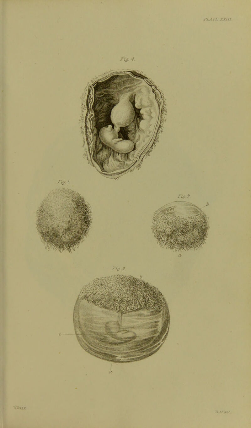 J'LATK XXllJ. Fig. 4. li. Adiacd.