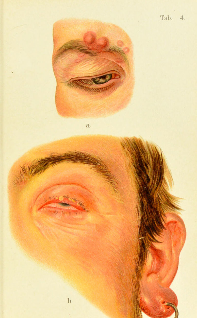 Tab. 4.