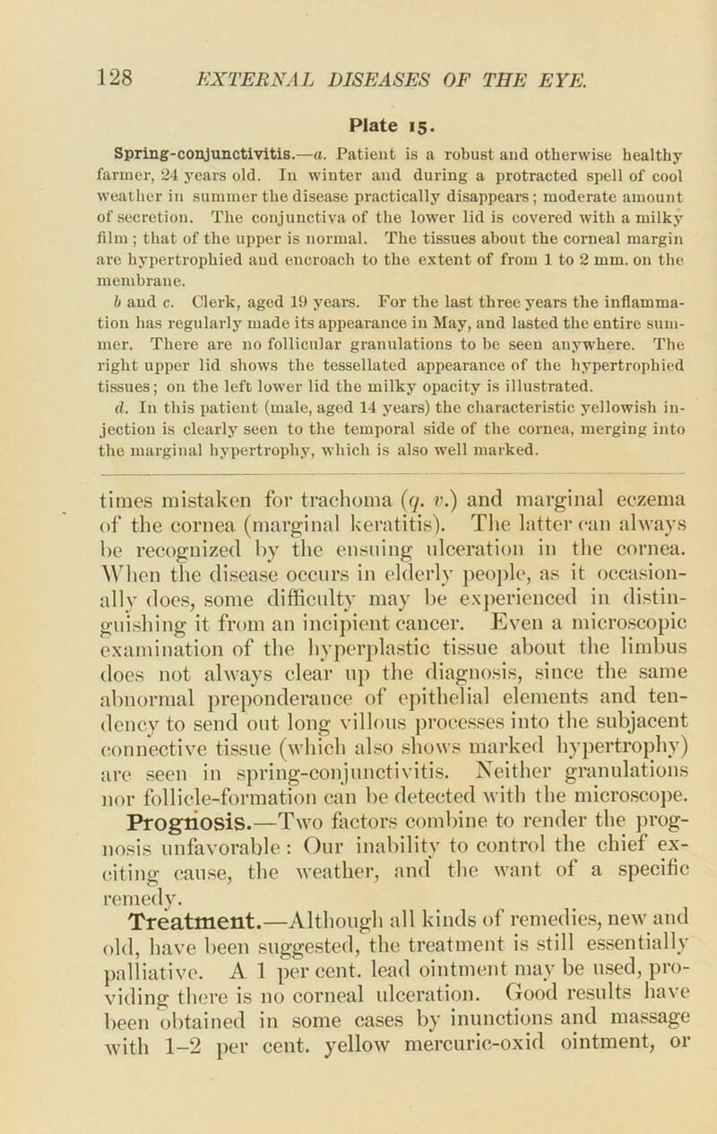 Plate 15. Spring-conjunctivitis.—a. Patient is a robust aud otherwise healthy farmer, 24 years old. In winter and during a protracted spell of cool weather in summer the disease practically disappeare; moderate amount of secretion. The conjunctiva of the lower lid is covered with a milky film ; that of the upper is normal. The tissues about the corneal margin are hypertrophied aud encroach to the extent of from 1 to 2 mm. on the membrane. b aud c. Clerk, aged 19 years. For the last three years the inflamma- tion has regularly made its appearance in May, and lasted the entire sum- mer. There are no follicular granulations to he seen anywhere. The right upper lid shows the tessellated appearance of the hypertrophied tissues; on the left lower lid the milky opacity is illustrated. d. In this patient (male, aged 14 years) the characteristic yellowish in- jection is clearly seen to the temporal side of the cornea, merging into the marginal hypertrophy, which is also well marked. times mistaken for trachoma {q. v.) and marginal eczema of the cornea (marginal keratitis'). The latter can always be recognized by the ensuing ulceration in the cornea. When the disease occurs in ehlerly pcojilc, as it occasion- ally does, some difficidty may be e.xjierienced in distin- gni.shing it from an incipient cancer. Even a micro.scopic examination of the hyperpla.stic ti.ssue about the limbus does not always clear np the diagnosis, since the .same abnormal preponderance of epithelial elements and ten- dency to send out long villous processes into the subjacent connective ti.ssue (which al.so shows marked hypertrophy) are seen in spring-conjunctivitis. Neither granulations nor follicle-formation can be detected with the micro.scope. Prognosis.—Two factors combine to render the ]H’og- nosis unfavorable: Our inability to control the chief ex- (itins: cau.se, the weather, and the want of a specific remedy. Treatment.—Although all kinds of remedies, new and old, have been suggested, the treatment is still essentially palliative. A 1 per cent, lead ointment may be used, pro- viding there is no corneal ulceration. Good results have been obtained in some cases by inunctions and massage with 1-2 per cent, yellow mercuric-oxid ointment, or