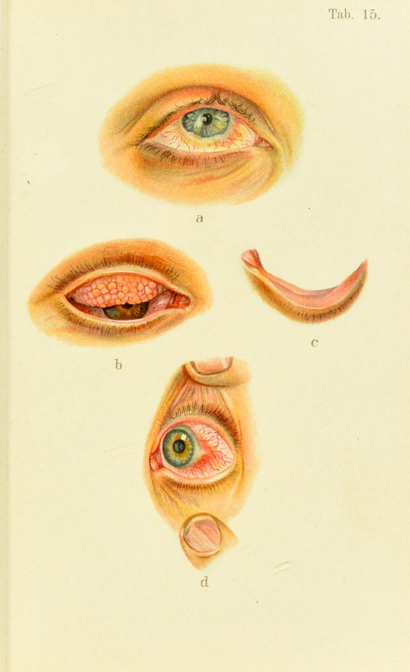 Tab. 15.