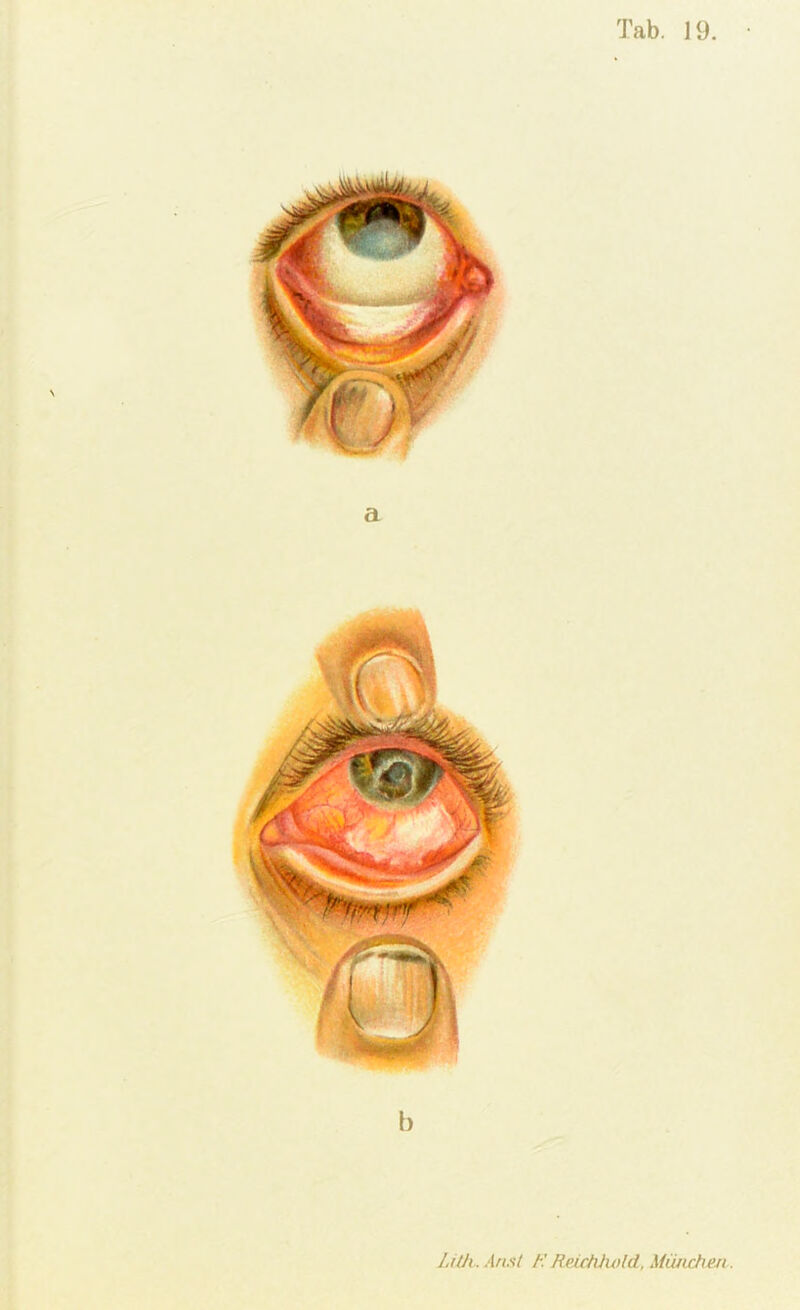 Tab. 19. • a Lith.Ansl t'. KeicMu)ld, Miuichen.