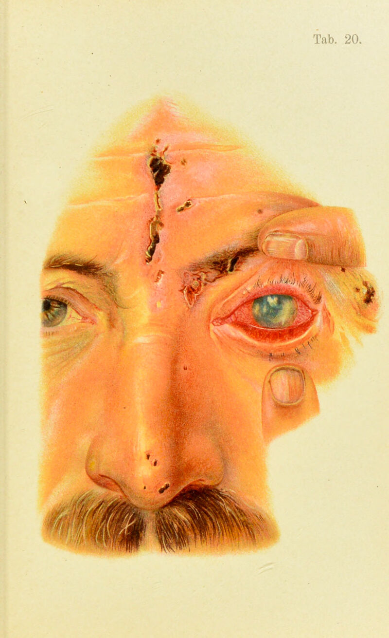 Tab. 20,