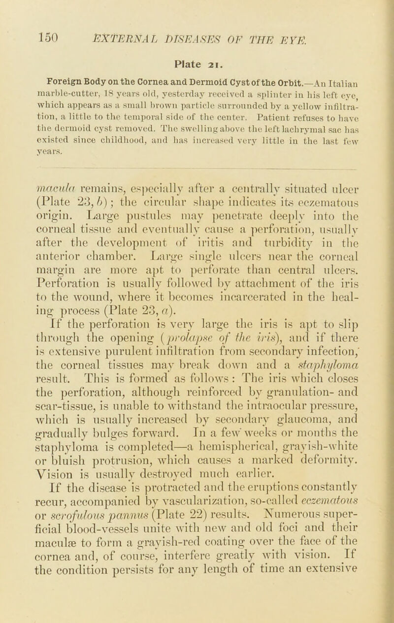 Plate 21. Foreign Body on the Cornea and Dermoid Cyst of the Orbit.—An Italian inarl)le-cnttcr, 18 years old, yesterday received a splinter in his left eye which appears as a small brown particle surrounded by a yellow infiltra- tion, a little to the temi)oral side of the center. Patient refu.ses to have the dermoid cyst removed. The swelling above the left lachrymal sac has existed since childhood, and has increased very little in the last few years. macul(( rcMiiain.s, es|)eci:illy :ifter a centrally situated ulcer (Plate 2d, h); the circailar shape indicates its cczeiufitous origin. Large pustules may penetrate deeply into the corneal ti.ssne and eventmdly cause a perforation, nsnallv after the development of iritis and turbidity in the anterior chambei’. L:irge single ulcers near the corneal margin are more a[)t to perforate than central ulcers. Perforation is usually followed by attachment of the iris to the wound, where it becomes iiuiarcerated in the heal- ing process (Plate 23, o). If the perforation is very large the iris is apt to .slip through the opening [prolapse of the iris), and if there is extensive purulent infiltration from .secondary infection,' the corneal tissues may break down and a staphyloma result. This is formed as follows; The iris which closes the perforation, although reinforced by granulation- and scar-tissue, is unable to withstand the intraocular pressure, which is usually increased by .secondary glaucoma, and gradiudly bulges forward. In a few'weeks or months the staphyloma is completed—a hemispherical, grayish-white or bluish ])rotrusion, which caiuses a marked deformity. Vision is usually destroyed much earlier. If the disease is protracted and the eruptions constantly recur, accompanied by vascularization, so-called eczematous or scrofulous jjannms (Plate 22) results. Numerous sujjer- ficial blood-vessels unite with new and old foci and their maculfe to form a grayish-red coating over the foce of the cornea and, of conr.se, interfere greatly with vision. If the condition persists for any length of time an extensive