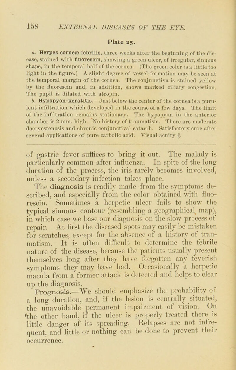 Plate 25. a. Herpes corneae febrilis, three weeks after the beginning of the dis- ease, stained with fluorescin, showing a green ulcer, of irregular, sinuous shape, in the temporal half of the cornea. (The green color is a little too light in the figure.) A slight degree of vessel-formation may be seen at the temporal margin of the cornea. The conjunctiva is stained yellow by the flnoresciu and, in addition, shows marked ciliary congestion. The pupil is dilated with atrojiin. b. Hypopyon-keratitis.—Just below the center of the cornea is a puru- lent infiltration which developed in the course of a few days. The limit of the infiltration remains stationary. The hypopyon in the anterior chamber is 2 mm. high. No history of traumatism. There are moderate dacryosteuosis and chronic conjunctival catarrh. Satisfactory cure after several applications of pure carbolic acid. Visual acuity §. of gastric fever suffices to bring it out. The malady is ]iarticularly common after influenza. In spite of tlie long duration of the process, tlie iris rarely becomes involved, unle.ss a secondary infection takes place. The diagnosis is readily made from the symptoms dc- .scribed, and e.specially from the color obtained vith fluo- rescin. Sometimes a herpetic ulcer fails to .sliow the typical sinuous contour (re.^^embling a geograj)hica\ map), in which case we base our diaguo.sis on the slow proee.ss of repair. At first the di.seased s[)ots may easily be mistaken for scratches, exeept for the absence of a history of trau- matism. It is often diffieult to determine the febrile nature of the disea.se, because the patients usually present themselves long after they have forgotten any feverish .sym])toms they may have had. Occasionally a herjK'tic macula from a former attack is detected and helps to clear up the diagnosis. Prognosis.—We should emjfliasize the ])robability of a long duration, and, if the Ivsion is centrally situated, the unavoidable ])crmanent impairment of vi.sion. On ‘'the other hand, if the ulcer is properly treated there is little danger of its spreading. Relapses are not infre- quent, and little or nothing can be done to prevent their occurrence.