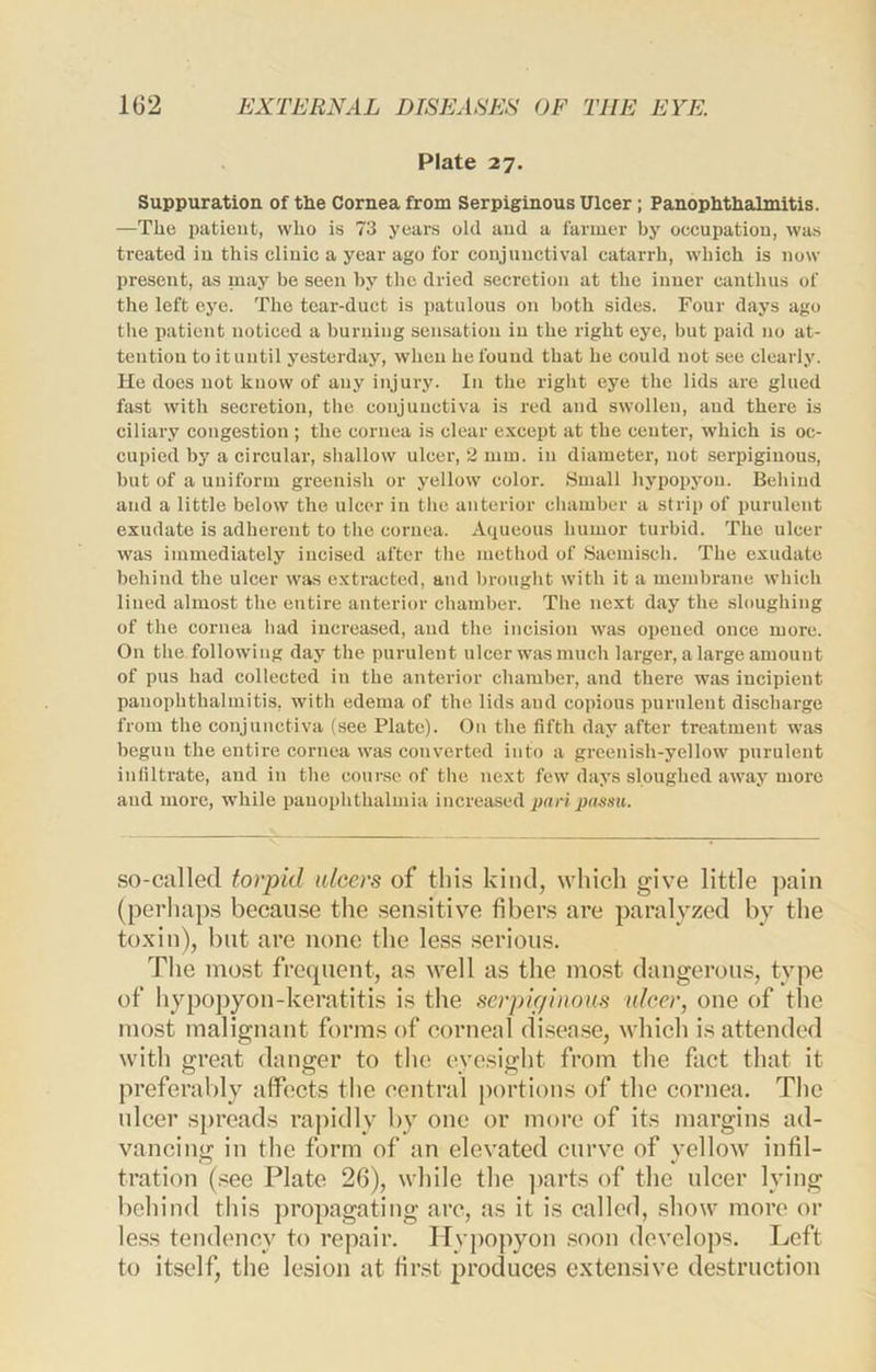Plate 27. Suppuration of the Cornea from Serpiginous Ulcer; Panophthalmitis. —The patient, who is 73 years old and a farmer by occupation, wa.s treated in this clinic a year ago for conjunctival catarrh, which is now present, as may be seen by tlic dried secretion at the inner canthus of the left eye. The tear-duct is patulous on both sides. Four days ago the patient noticed a burning sensation in the right eye, but paid no at- tention to it until yesterday, when he found that he could not see clearly. He does not know of any injury. In the right eye the lids are glued fast with secretion, the conjunctiva is red and swollen, and there is ciliary congestion ; the cornea is clear except at the center, which is oc- cupied by a circular, shallow ulcer, 2 mm. in diameter, not serpiginous, but of a uuiibrm greenish or yellow color. Small hypopyon. Behind and a little below the ulcer in tlie anterior cliamber a strip of purulent exudate is adherent to tlie cornea. Aqueous humor turbid. The ulcer was immediately incised after the method of Saemiscli. The exudate behind the ulcer was e.xtracted, and brought with it a membrane which lined almost the entire anterior chamber. The next day the sloughing of the cornea liad increased, and the incision was opened once more. On the following day the purulent ulcer was much larger, a large amount of pus had collected in the anterior cliamber, and there was incipient panophthalmitis, with edema of the lids and copious purulent discharge from the conjunctiva (see Plate). On the fifth day after treatment was begun the entire cornea was converted into a greenish-yellow purulent infiltrate, and in the course of the next few days sloughed away more and more, while panophthalmia increased pari passit. so-called torpid ulcers of this kind, which give little pain (perhaps because the sensitive fibers are paralyzed by the toxin), blit are none the less .serious. The most frequent, as well as the most dangerous, type of hypopyon-keratitis is the serpif/inous ulcer, one of the most malignant forms of corneal disease, which is attended with great danger to the eyesight from the fact that it preferably affects the central jiortions of the cornea. The nicer spreads rapidly by one or more of its margins ad- vancinif in the form of an elevated curve of vellow infil- tration (see Plate 26), while the ])arts of the nicer lying behind this propagating arc, as it is called, show more or less tendency to repair. Hypopyon .soon develops. Left to itself, the lesion at first procluces exten.sive destruction