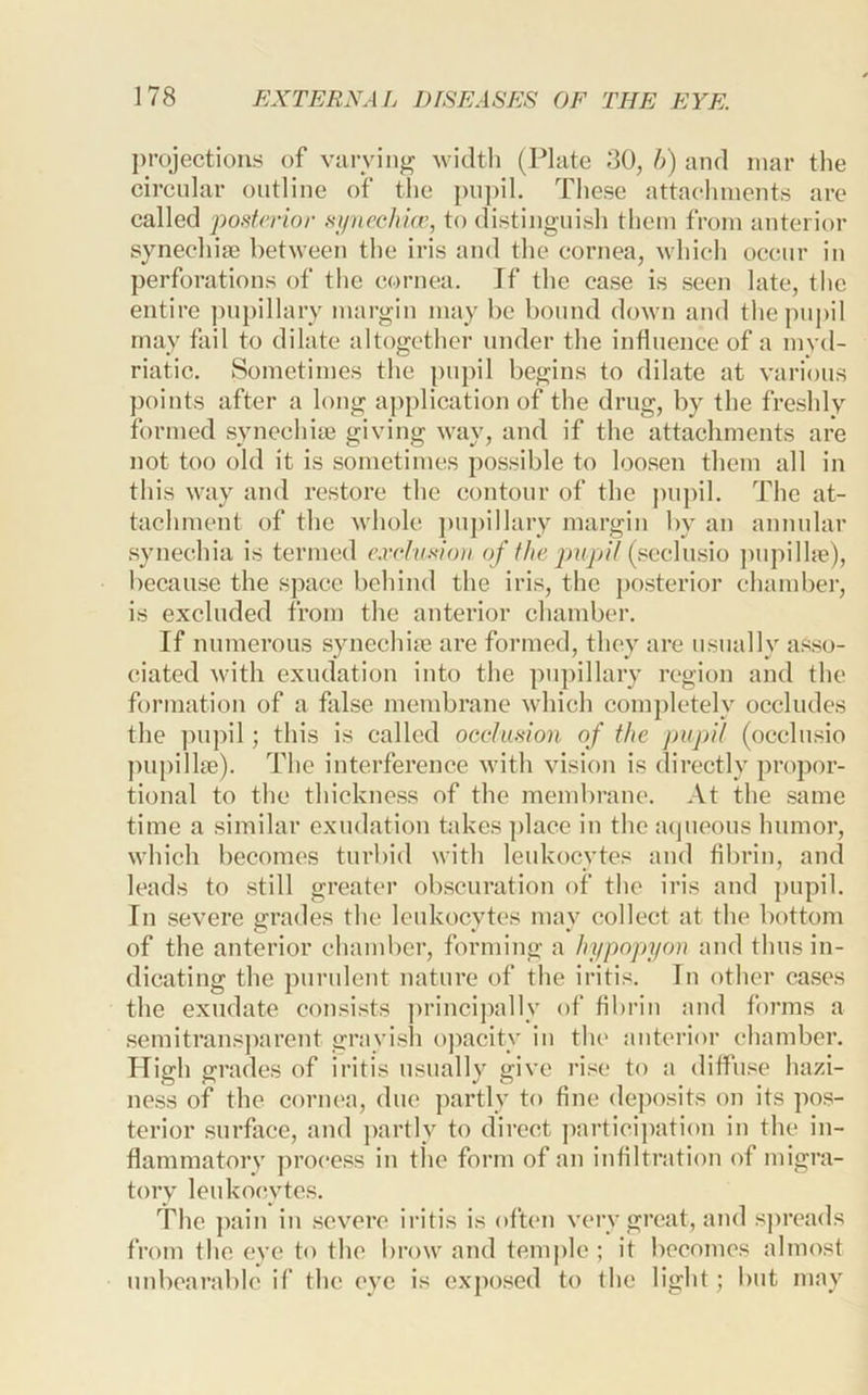 ])rojectioiis of varying 'widtli (Plate 30, h) and mar the cireular outline of tlie pu])il. These attachments are called posterior si/nechicr, to distinguish them from anterior synechiae between the iris and the cornea, M'hicli occur in perforations of the cornea. If the ease is seen late, the entire ]mpillary margin may be bound down and the pupil may fail to dilate altogether under the infinence of a myd- riatic. Sometimes the pnj)il begins to dilate at various points after a long application of the drug, by the freshly formed synechite giving way, and if the attachments are not too old it is sometimes possible to loosen them all in this way and restore the contour of the pupil. The at- tachment of the whole j)n])illary margin by an annular .synechia is termed c.rc/a.v/oa of the pupil (f>cc\us\o ])upill{e), becau.se the space behind the iris, the po.sterior chamber, is excluded from the anterior chamber. If numerous synechise are formed, they are usually a.sso- ciated with exudation into the pupillary region and the formation of a false membrane which comj)letely occludes the pupil; this is called occlusion of the pupil (occlusio jnipilke). The interference with vision is directly propor- tional to the thickness of the membrane. At the .same time a similar exudation takes ])lace in the aqueous humor, which becomes turbid with leukocytes and fibrin, and leads to still greater obscuration of the iris and pupil. In severe ijrades the leukoevtes mav collect at the bottom of the anterior ehamber, forming a hypojtyou and thus in- dicating the pundent nature of the iritis. In other cases the exudate consi.sts ])riucij)ally of fibrin and forms a semitrans])arent grayish ojiacity in the anterior chamber. High grades of iritis usually give ri.^^e to a diffuse hazi- ness of the cornea, due partly to fine deposits on its pos- terior surface, and ])artly to direct ])articipation in the in- flammatory proce.'^s in the form of an infiltration of migra- tory leukoewtes. The ])ain in .severe iritis is often very great, and s])reads from the eye to the brow and teni])le ; it becomes almost unbearable if’ the eye is exposed to the light; but may