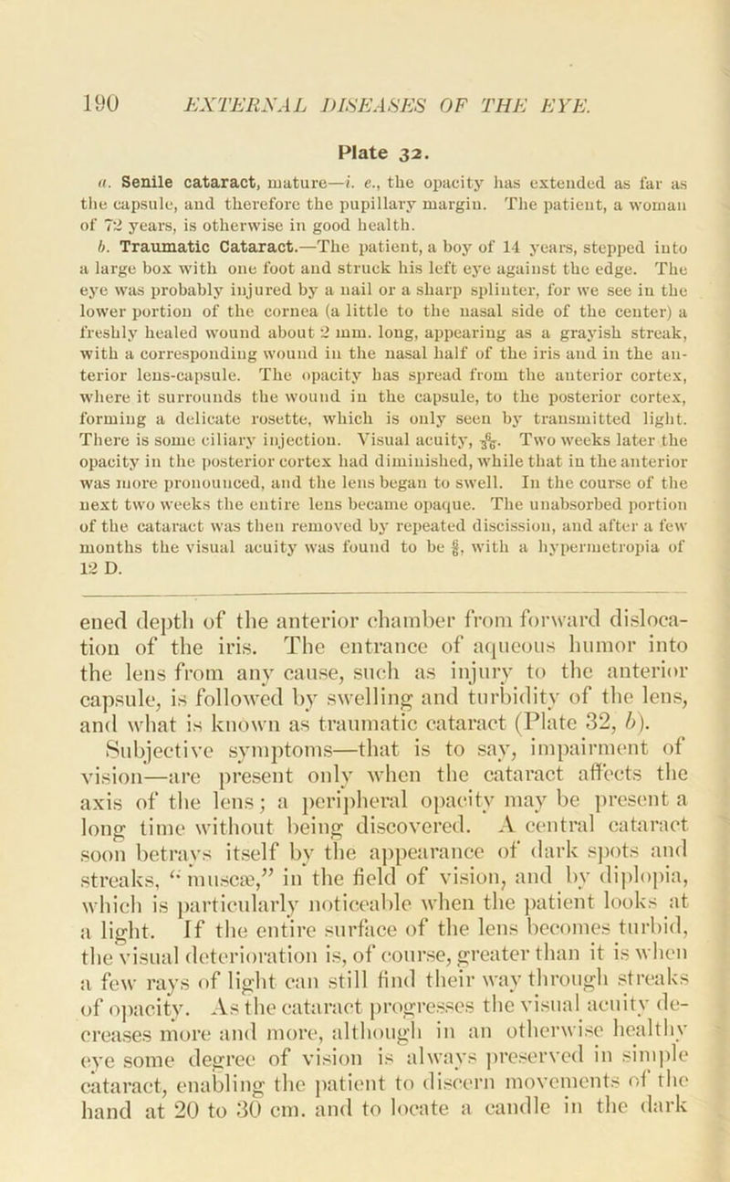 Plate 32. rt. Senile cataract, mature—/. e., the opacity lias extended as far as tlie capsule, and therefore the pupillary margin. The patient, a woman of 12 years, is otherwise in good health. b. Traumatic Cataract.—The patient, a boy of 14 yeai-s, stepped into a large box with one foot and struck his left eye against the edge. The eye was probably injured by a nail or a sharp splinter, for we see in the lower portion of the cornea (a little to the nasal side of the center) a freshly healed wound about 2 mm. long, appearing as a grayish streak, with a corresponding wound in the nasal half of the iris and in the an- terior lens-capsule. The opacity has spread from the anterior cortex, where it surrounds the wound in the capsule, to the posterior cortex, forming a delicate rosette, which is only seen by transmitted light. There is some ciliary injection. Visual acuity, 5%. Two weeks later the opacity in the posterior cortex had diminished, while that in the anterior was more pronounced, and the lens began to swell. In the course of the next two weeks the entire lens became opaque. The unabsorbed portion of the. cataract was then removed by repeated discission, and after a few months the visual acuity was found to be §, with a hypermetropia of 12 D. eued depth of the anterior chamber from forward disloca- tion of the iris. The entrance of atpieons humor into the lens from any cause, such as injury to the anterior capsule, is followed by swelling and turbidity of the lens, and what is known as traumatic cataract (Plate 32, h). Subjective symptoms—that is to say, impairment of vision—are present only when the cataract affects the axis of the lens; a jierijiheral opacity may be present a long time without being di.scovered. A central cataract soon betrays itself by the a])pearance of dark s])ots and .streaks, ‘' muscie,” in the field of vision, and by dijdopia, which is particularly noticeable when the patient looks at a light. If the entire surface of the lens becomes turbid, the visual deterioration is, of course, greater than it is when a few rays of light can still find their way through streaks of ojKicity. As the cataract progre.s.^es the visual acuity de- creases more and more, although in au ofherwi.'^e healthy eye some degree of vision is always ])re.servcd in sinij)lc cataract, enabling the j)atient to discern movements of the hand at 20 to 30 cm. and to locate a candle in the dark