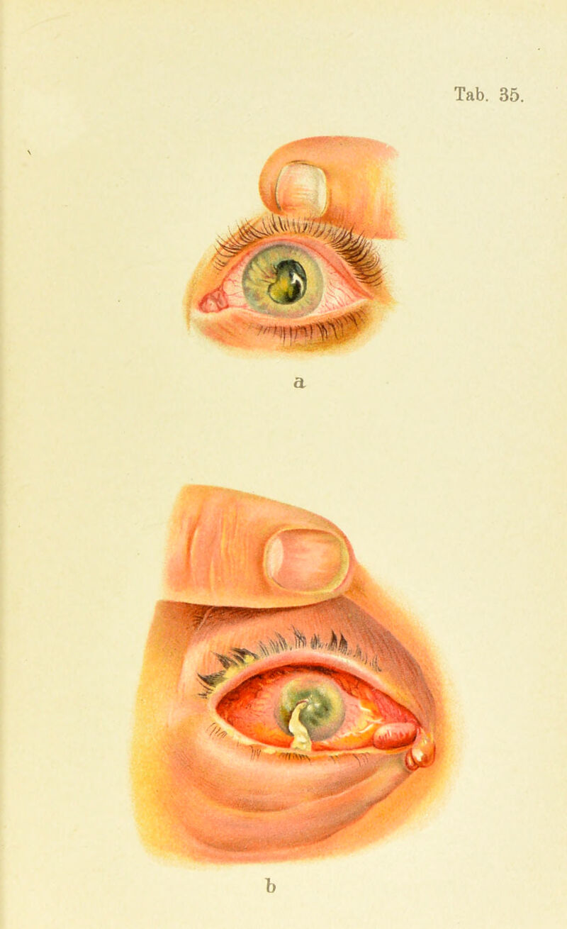 Tab. 35. b