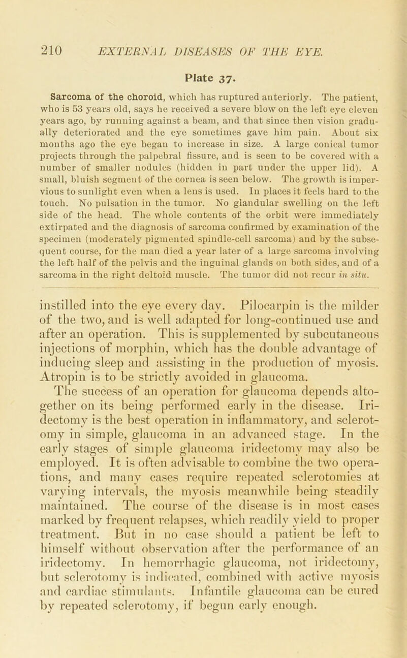 Plate 37. Sarcoma of the choroid, which has ruptured anteriorly. The patient, who is 53 years old, says he received a severe blow on the left eye eleven years ago, by running against a beam, and that since then vision gradu- ally deteriorated and the eye sometimes gave him pain. About six mouths ago the eye began to increase in size. A large conical tumor projects through the palj)ebral fissure, and is seen to be covered with a number of smaller nodules (hidden in part under the upper lid). A small, bluish segment of the cornea is seen below. The growtli is imper- vious to sunlight even when a lens is used. In places it feels hard to the touch. No pulsation in the tumor. No glandular swelling on the left side of the head. The whole contents of the orbit were immediately extirpated and the diagnosis of .sarcoma confirmed by examination of the specimen (moderately pigmented spiudle-eell sarcoma) and by the subse- quent course, for the man died a year later of a large sarcoma involving the left half of the j)elvis and the inguinal glands on both sides, and of a sarcoma in the right deltoid mu.scle. The tumor did not recur in sHit. instilled into the eye every day. Pilocar|)in is the milder of the two, and is well adapted for long-eontinued use and after an operation. This is supplemented by subcutaneous injections of morphin, which has the double advantage of inducing sleep and a.ssisting in the jiroduction of myosis. Atropin is to be strictly avoided in glaucoma. The success of an operation for glaucoma depends alto- gether on its being performed early in the disease. Iri- dectomy is the best operation in inflammatory, and sclerot- omy in simple, glaucoma in an advanced stage. In the early stages of simjfle glaucoma iridectomy may also be employed. It is often advisable to combine the two opera- tions, and many cases require rej>eated sclerotomies at varying intervals, the myosis meanwhile being steadily maintained. The course of the disease is in most cases marked by frequent relaj)se.s, which readily yield to proper treatment. But in no case should a patient be left to himself without observation after the ])erformance of an iridectomy. In hemorrhagic glaucoma, not iridectomy, l)iit .sclerotomy is indicated, combined Avith active myosis and cardiac stimulants. Infantile glaucoma can be cured by repeated .sclerotomy, if begun early enough.