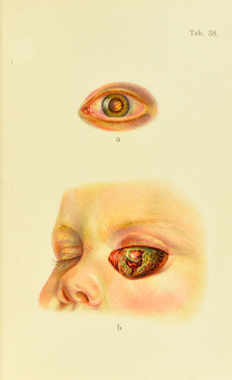 a b