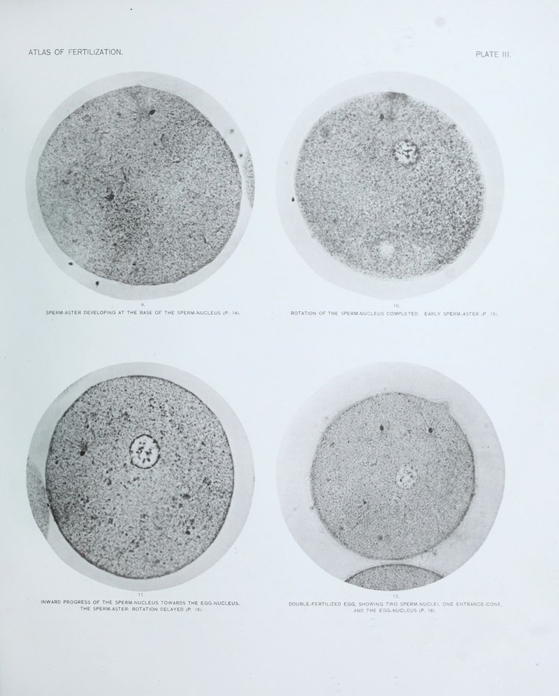 9. SPERM-ASTER DEVELOPING AT THE BASE OF THE SPERM-NUCLEUS (P. 14). 10. ROTATION OF THE SPERM-NUCLEUS COMPLETED. EARLY SPERM-ASTER -P 15. 11 INWARD PROGRESS OF THE SPERM-NUCLEUS TOWARDS THE EGG-NUCLEUS. THE SPERM-ASTER; ROTATION DELAYED (P. 16). DOUBLE-FERTILIZED EGG, SHOWING TWO SPERM-NUCLEI, ONE ENTRANCE-CONE. AND THE EGG-NUCLEUS (P. 16).