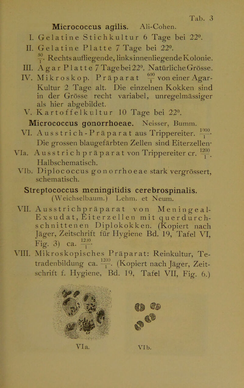 Micrococcus agilis. Ali-Cohen. I. Gelatine Stichkultur 6 Tage bei 22°. II. Gelatine Platte / Tage bei 22°. y. Rechts aulliegende, links innenliegende Kolonie. III. Agar Platte 7Tagebei22°. Natürliche Grösse. IV. Mikroskop. Präparat ^ von einer Agar- Kultur 2 Tage alt. Die einzelnen Kokken sind in der Grösse recht variabel, unregelmässiger als hier abgebildet. Y. Kartoffelkultur 10 Tage bei 22°. Micrococcus gonorrhoeae. Neisser, Bumm. VI. Ausstrich -Präparat aus Trippereiter. '-’00- Die grossen blaugefärbten Zellen sind Eiterzellen- Via. Ausstrich präparat von T rippereiter er. . Halbschematisch. Ylb. Diplococcus gono rrho eae stark vergrössert, schematisch. Streptococcus meningitidis cerebrospinalis. (Weichselbaum.) Lehm, et Neum. VII. Ausstrichpräparat von Meningeal- Exsudat, Eiterzellen mit querdurch- schnittenen Diplokokken. (Kopiert nach Jäger, Zeitschrift für Hygiene Bd. 19, Tafel VI, Fig. 3) ca. —• VIII. Mikroskopisches Präparat: Reinkultur, Te- tradenbildung ca. (Kopiert nach Jäger, Zeit- schrift f. Hygiene, Bd. 19, Tafel VII, Fig. 6.)