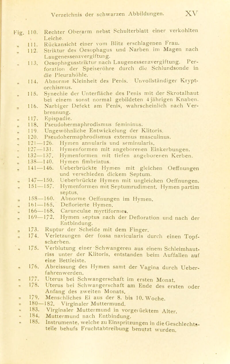 no. 111. 112. 113. 114. 115. 116. 117. 118. 119. 120. 121 — 127— 132— 138— 141— 147- 151— 158- 161- 166- 169— 173. 174. 175. 176. 177. 178. 179. 180- 183. 184. 185. Rechter Oberarm nebst Schulterblatt einer verkohlten Leiche. Riickansicht einer vom Blitz erschlagenen Frau. Striktur des Oesophagus und Narben ini Magen nach Laugenessenzvergiftung. Oesophagusstriktur nach Laugenessenzvergiftung. Per- foration der Speiserohre durch die Schlundsonde in die Pleurahohle. Abnorme Kleinheit des Penis. Unvollstandiger Krypt- orchismus. Synechie der Unterflache des Penis mit der Skrotalhaut bei einem sonst normal gebildeten 4jahrigen Knaben. Narbiger Defekt am Penis, wahrscheinlich nach Ver- brennung. Epispadie. Pseudohermaphrodismus femininus. Ungewohnliche Entvvickelung der Klitoris. Pseudohermaphrodismus externus masculinus. -126. Hymen annularis und seminularis. •131. Hymenformen mit angeborenen Einkerbungen. ■137. Hymenformen mit tiefen angeborenen Kerben. -140. Hymen fimbriatus. ■146. Ueberbriickte Hymen mit gleichen Oeffnungen und verschieden dickem Septum. -150. Ueberbriickte Hymen mit ungleichen Oeffnungen. -157. Hymenformen mit Septumrudiment. Hymen partim septus. -160. Abnorme Oeffnungen im Hymen. -165. Deflorierte Hymen. -168. Carunculae myrtiformes. -172. Hymen septus nach der Defloration und nach der Entbindung. Ruptur der Scheide mit dem Finger. Verletzungen der fossa navicularis durch einen Topf- scherben. Verblutung einer Schwangeren aus einem Schleimhaut- riss unter der Klitoris, entstanden beim Auffallen auf eine Bettleiste. Abreissung des Hymen samt der Vagina durch Ueber- fahrenwerden. Uterus bei Schwangerschaft im ersten Monat. Uterus bei Schwangerschaft am Ende des ersten oder Anfang des zweiten Monats. Menschliches Ei aus der 8. bis 10. Woche. -182. Virginaler Muttermund. Virginaler Muttermund in vorgeiiicktem Alter. Muttermund nach Entbindung. Instrumente, welche zu Einspritzungen in die Geschlechts- teile behufs Fruchtabtreibung benutzt wurden.