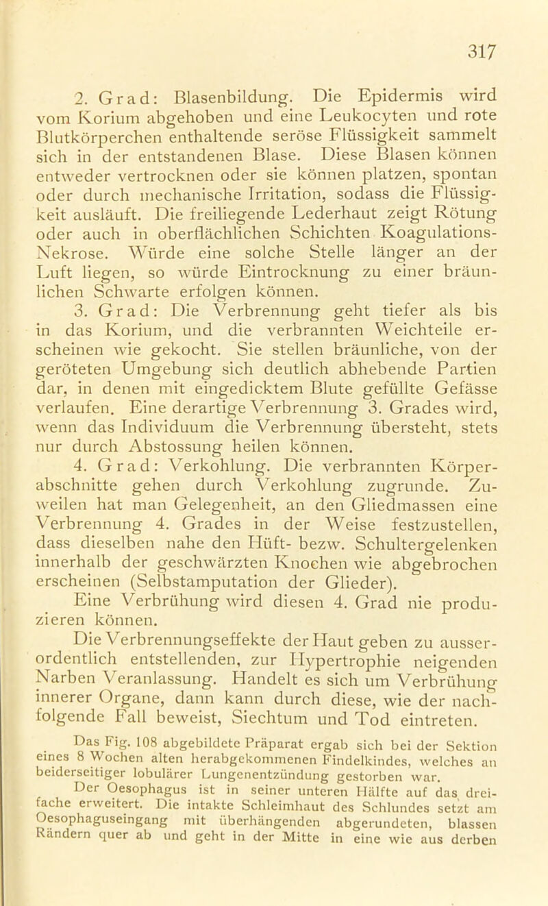 2. Grad: Blasenbildung. Die Epidermis wird vora Korium abgehoben und eine Leukocyten und rote Blutkorperchen enthaltende serose Flussigkeit sammelt sich in der entstandenen Blase. Diese Blasen konnen entweder vertrocknen oder sie konnen platzen, spontan oder durch mechanische Irritation, sodass die Flussig- keit auslauft. Die freiliegende Lederhaut zeigt Rotung oder auch in oberflachlichen Schichten Koagulations- Nekrose. Wurde eine solche Stelle langer an der Luft liegen, so wurde Eintrocknung zu einer braun- lichen Schwarte erfolgen konnen. 3. Grad: Die Verbrennung geht tiefer als bis in das Korium, und die verbrannten Weichteile er- scheinen wie gekocht. Sie stellen braunliche, von der geroteten Umgebung sich deutlich abhebende Partien dar, in denen mit eingedicktem Blute gefiillte Gefitsse verlaufen. Eine derartige Verbrennung 3. Grades wird, wenn das Individuum die Verbrennung iibersteht, stets nur durch Abstossung heilen konnen. 4. Grad: Verkohlung. Die verbrannten Korper- abschnitte gehen durch Verkohlung zugrunde. Zu- weilen hat man Gelegenheit, an den Gliedmassen eine Verbrennung 4. Grades in der Weise festzustellen, dass dieselben nahe den Huft- bezw. Schultergelenken innerhalb der geschwilrzten Knoehen wie abgebrochen erscheinen (Selbstamputation der Glieder). Eine Verbriihung wird diesen 4. Grad nie produ- zieren konnen. Die Verbrennungseffekte derHautgeben zu ausser- ordentlich entstellenden, zur Hypertrophie neigenden Narben Veranlassung. Handelt es sich um Verbriihung innerer Organe, dann kann durch diese, wie der nacli- folgende Fall beweist, Siechtum und Tod eintreten. Das Fig. 108 abgebildete Praparat ergab sich bei der Sektion eines 8 Wochen alien herabgekommenen Findelkindes, welches an beiderseitiger lobularer Lungenentziindung gestorben war. Der Oesophagus ist in seiner unteren Halfte auf das drei- fache erweitert. Die intakte Schleimhaut des Schlundes setzt am Oesophaguseingang mit iiberhangenden abgerundeten, blassen Kiindern quer ab und geht in der Mitte in eine wie aus derben