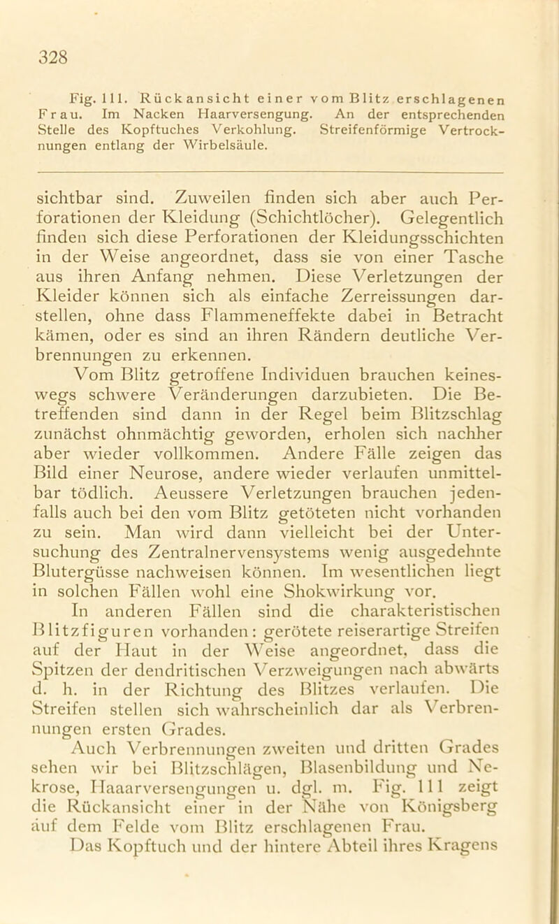 328 Fig. 111. Riickansicht einer vom Blitz erschlagenen Frau. Im Nacken Haarversengung. An der entsprechenden Stelle des Kopftuches Verkohlung. Streifenformige Vertrock- nungen entlang der Wirbelsaule. sichtbar sind. Zuweilen finden sich aber auch Per- forationen der Kleidung (Schichtlocher). Gelegentlich finden sich diese Perforationen der Kleidungsschichten in der Weise angeordnet, dass sie von einer Tasche aus ihren Anfang nehmen. Diese Verletzungen der Kleider konnen sicb als einfache Zerreissungen dar- stellen, ohne dass Flammeneffekte dabei in Betracht kamen, oder es sind an ihren Randern deutliche Ver- brennungen zu erkennen. Vom Blitz getroffene Individuen brauchen keines- wegs schwere Veranderungen darznbieten. Die Be- treffenden sind dann in der Regel beim Blitzschlag zunachst ohnmachtig geworden, erholen sicb nachher aber wieder vollkommen. Andere Falle zeigen das Bild einer Neurose, andere wieder verlaufen unmittel- bar todlich. Aeussere Verletzungen brauchen jeden- falls auch bei den vom Blitz getoteten nicht vorhanden zu sein. Man wird dann vielleicht bei der Unter- suchung des Zentralnervensystems wenig ausgedehnte Blutergiisse nachweisen konnen. Im wesentlicben liegt in solchen Fallen wohl eine Sbokwirkung vor. In anderen Fallen sind die charakteristischen Blitzfiguren vorhanden: gerotete reiserartige Streifen auf der Flaut in der Weise angeordnet, dass die Spitzen der dendritiscben Verzweigungen nach abwarts d. h. in der Richtung des Blitzes verlaufen. Die Streifen stellen sich wahrscheinlich dar als Verbren- nungen ersten Grades. Auch Verbrennungen zweiten und dritten Grades sehen wir bei Blitzschlagen, Blasenbildung und Ne- krose, Flaaarversengungen u. dgl. m. Fig. 111 zeigt die Riickansicht einer in der Nellie von Konigsberg auf dem Felde vom Blitz erschlagenen Frau. Das Kopftuch und der hintere Abteil ihres Kragens