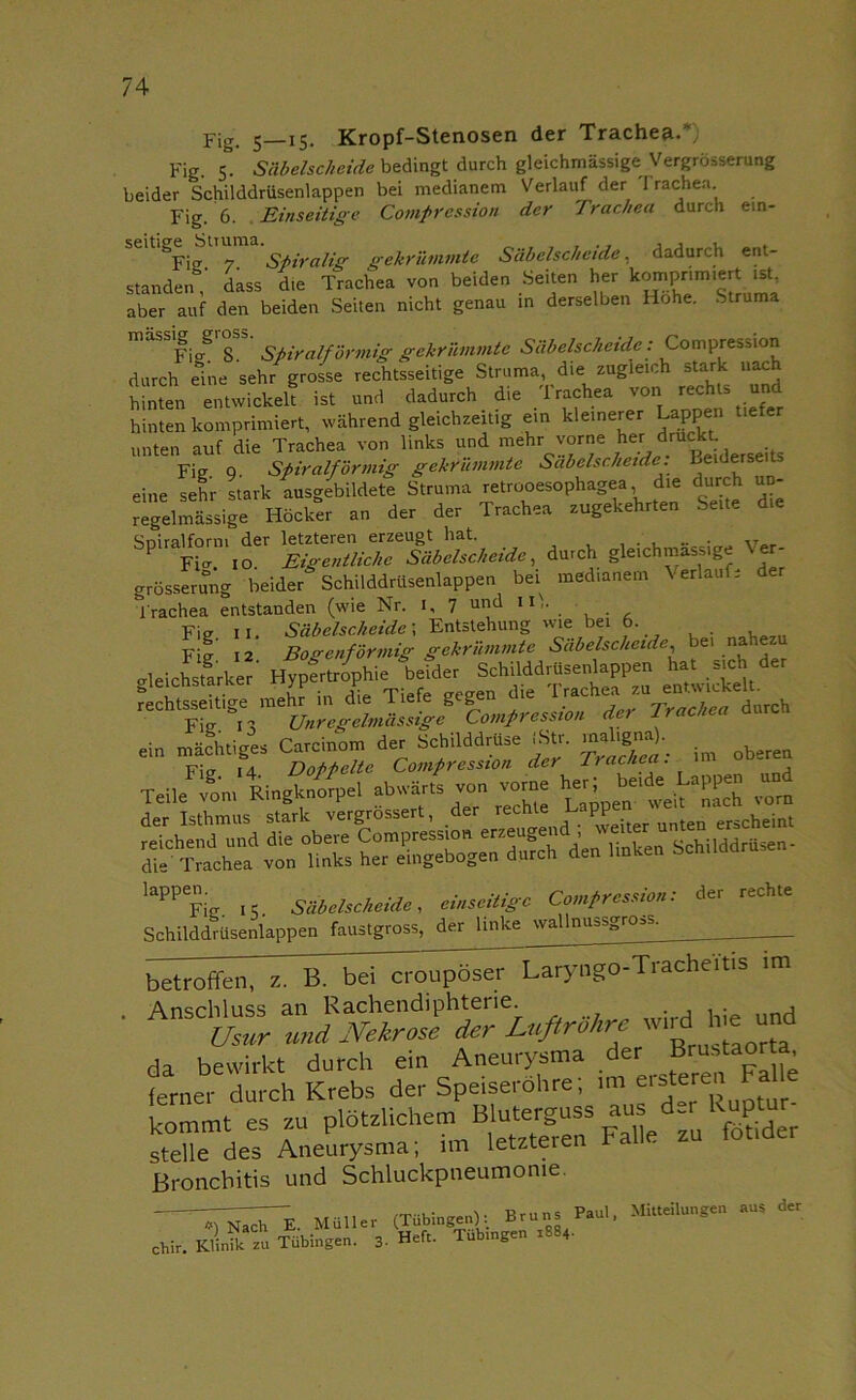 Fig. s—15. Kropf-Stenosen der Trachea.*, Fig. 5* Säbelscheide bedingt durch gleichmässige Vergrösserung beider Schilddrüsenlappen bei medianem Verlauf der '1 rachen. Fig. 6. Einseitige Compression der Trachea durch em- semge} Struma. ^ gekrümmte Säbelscheide, dadurch ent- standen dass die Trachea von beiden Seiten her kompnm^rtisb aber auf den beiden Seiten nicht genau in derselben Hohe. Struma massig g ^ spiralförmig gekrümmte Säbelscheide: Compression durch eine sehr grosse rechtsseitige Struma, die zugleich stark nach hinten entwickelt ist und dadurch die Trachea von rechts und hinten komprimiert, während gleichzeitig ein kleinerer Lappen tiefer unten auf die Trachea von links und ™hr vorne her d Be;derseits Fig q Spiralförmig gekrümmte Säbelscheide. Beiderse t eine sehr stark ausgebildete Struma retrooesophagea die durch un- regelmässige Höcler an der der Trachea zugekehrten Seite die Sniralform der letzteren erzeugt hat. Fia. io. Eigentliche Säbelscheide, durch gleichmässige grösserung beider Schilddrüsenlappen bei med.anem \ erlaufe der Irachea entstanden (wie Nr. i, 7 und IX-- . rechtsseitige mehr in die Tiefe g g Trachea durch Fi<r Unregelmässige Compression de, iracnea a ei» mächtiges Catcinom der Schilddrüse JStr. ».hg»»). Fig 14 Doppelte Compression der Trachea. - Teile^ vor»1 Ringknorpel abwärts von vor», N-Ujg £ der Isthmus stark vergrössert, der rechl^ LaPP.ter unten erscheint linken Schilddrüsen- lappen. Säbetscheide, einseitige Compression: der rechte Schilddrüsenlappen faustgross, der Unke wallnussgross. betroffen, z. ßTbd^oupöser Laryngo-Tracheitis im da bewirkt durch ein Aneurysma der Brustaorta ferner durch Krebs der Speiseröhre; im erste«* ^le kommt es zu plötzlichem Blutergusis aus d t- kuptu^ stelle des Aneurysma; un letzteren Fa - Bronchitis und Schluckpneumonie. ^T^Te. Müller (Tübingen): Bruns hui, Mitteilungen aus der Chir. Klinik zu Tübingen. 3- Heft. Tübingen 1884.
