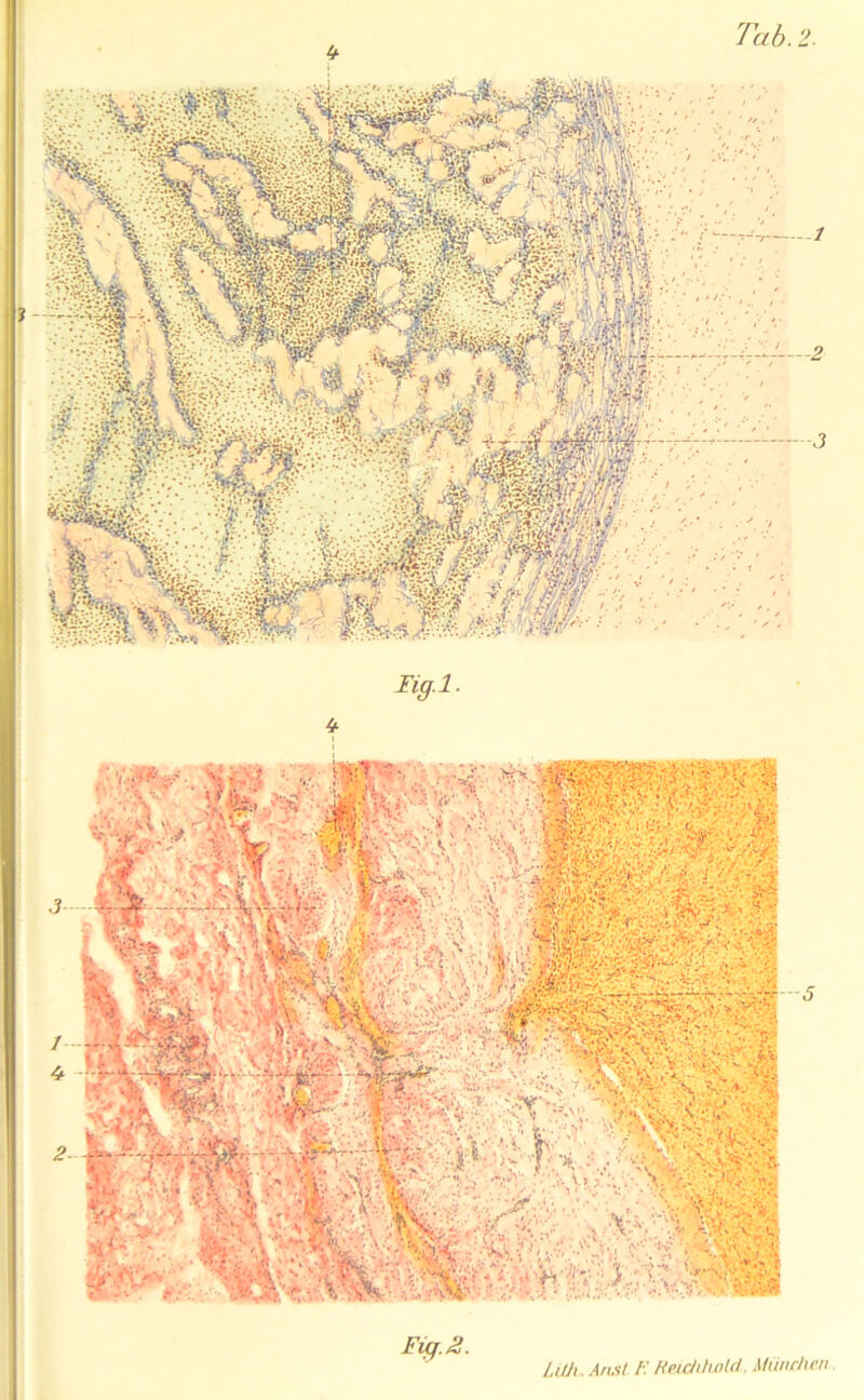 ligA. Fig.2. Tab. 2.